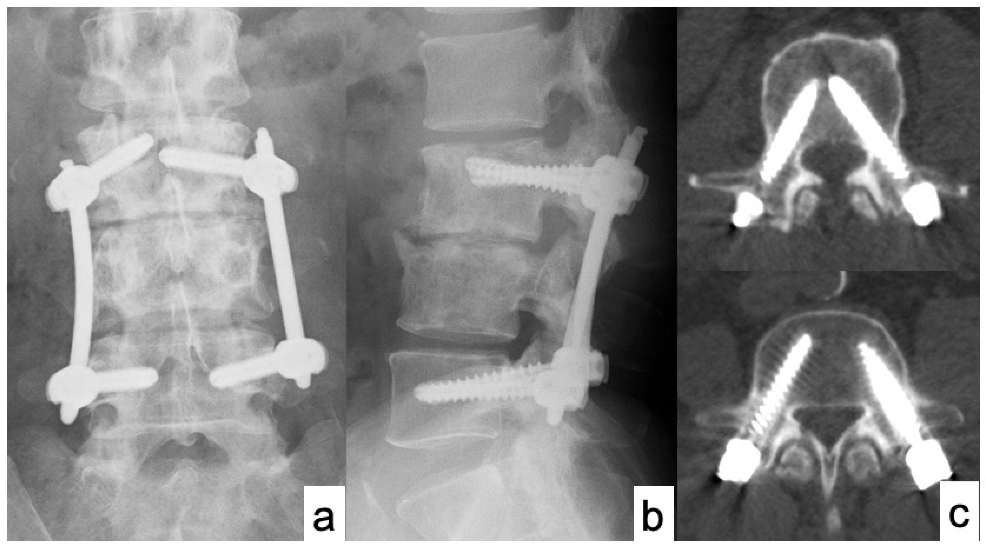 Medicina 58 00754 g002 Medicina 58 00754 g002
