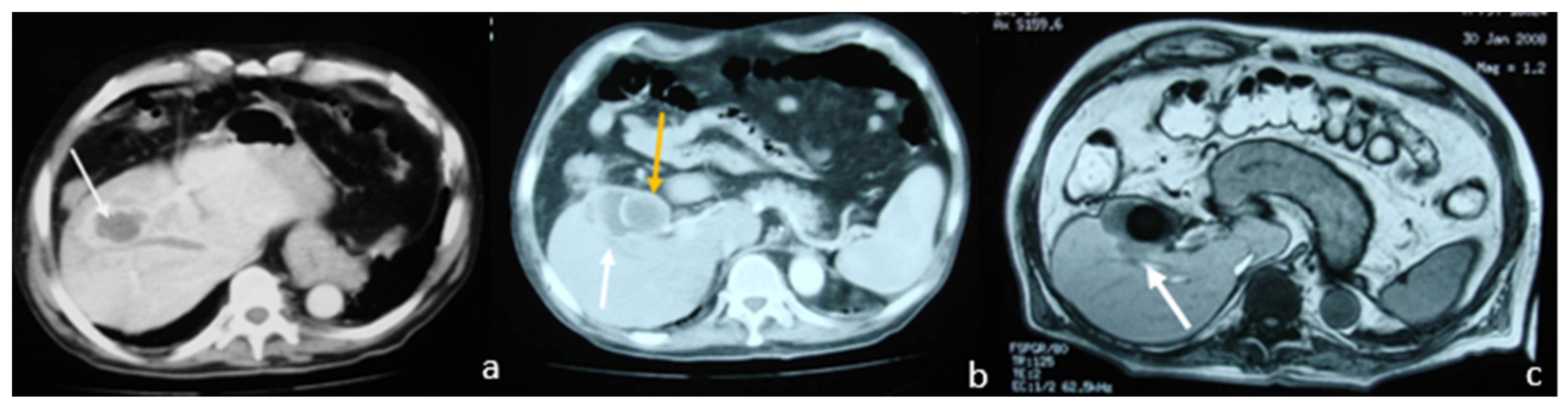 Medicina 58 00782 g004 Medicina 58 00782 g004