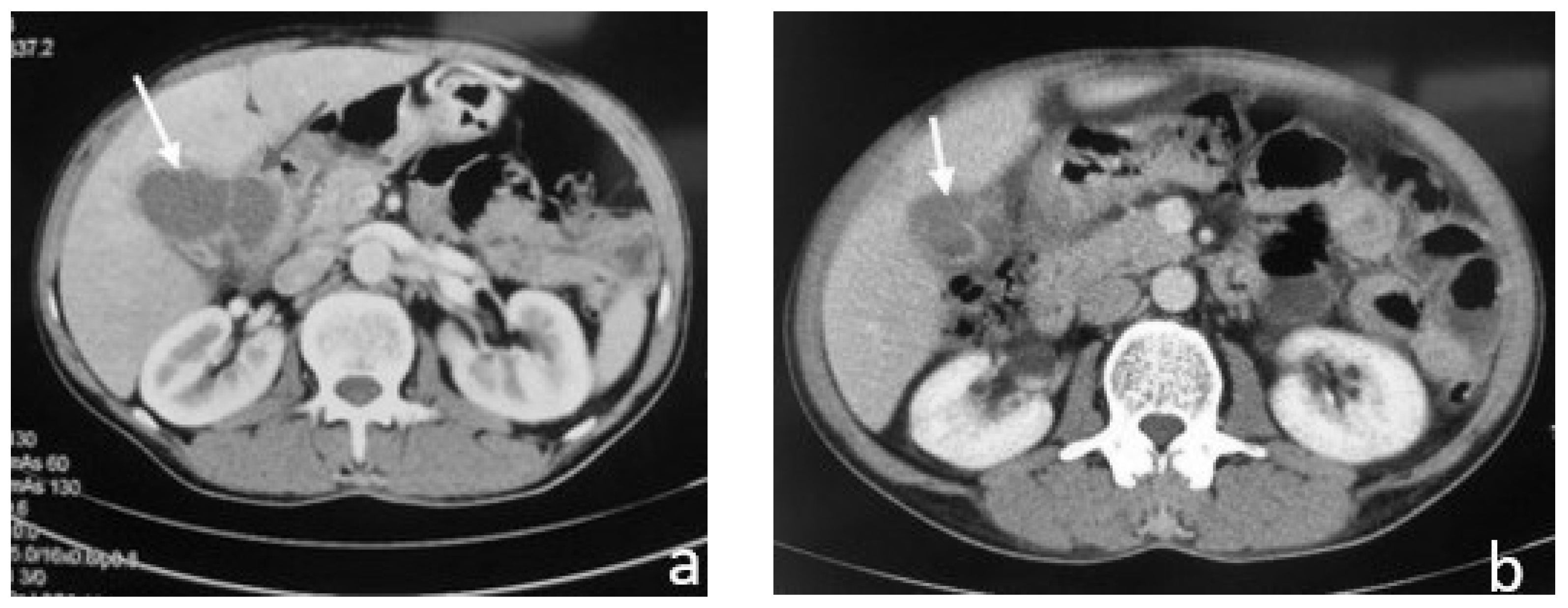Medicina 58 00782 g006 Medicina 58 00782 g006