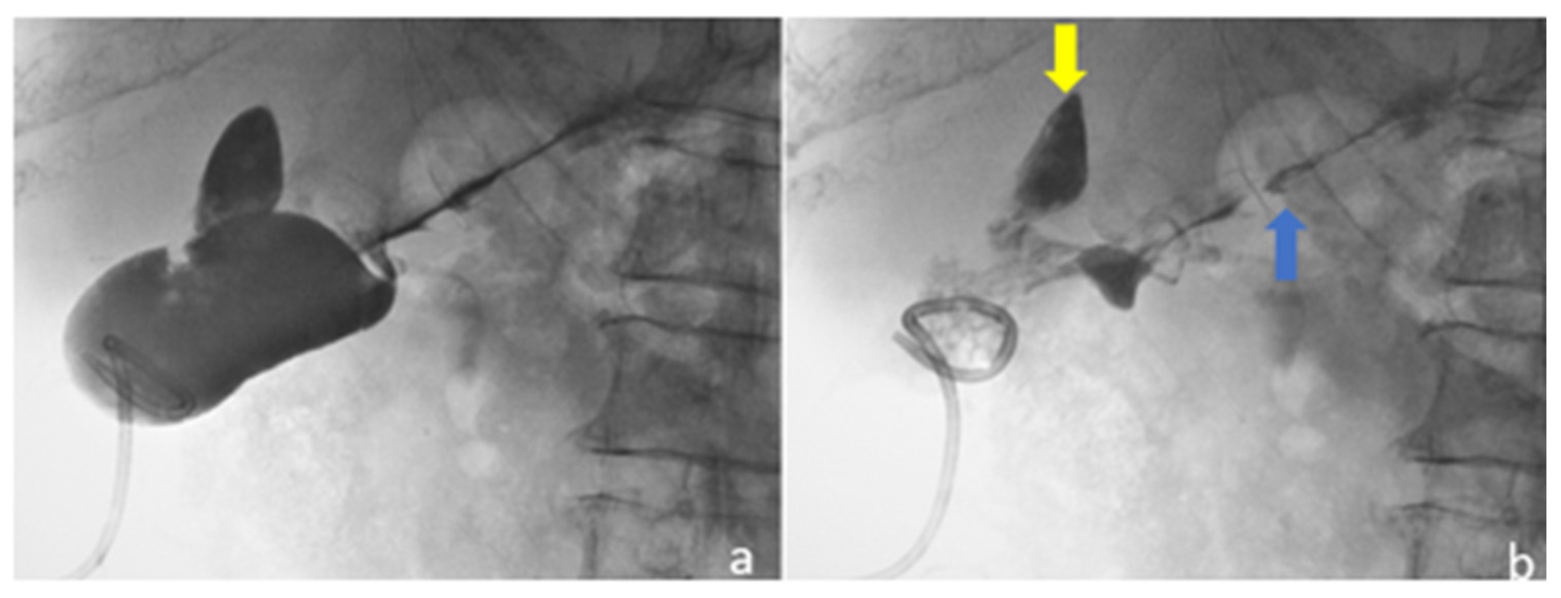 Medicina 58 00782 g007 Medicina 58 00782 g007