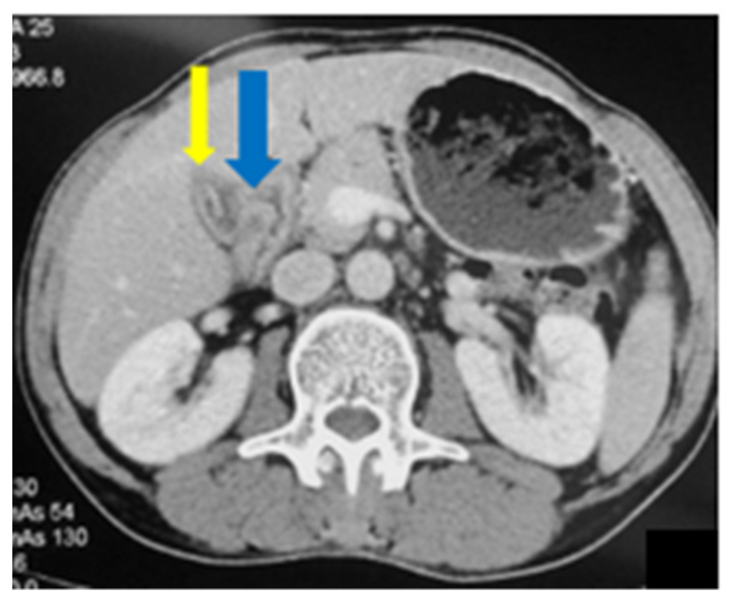 Medicina 58 00782 g008 Medicina 58 00782 g008