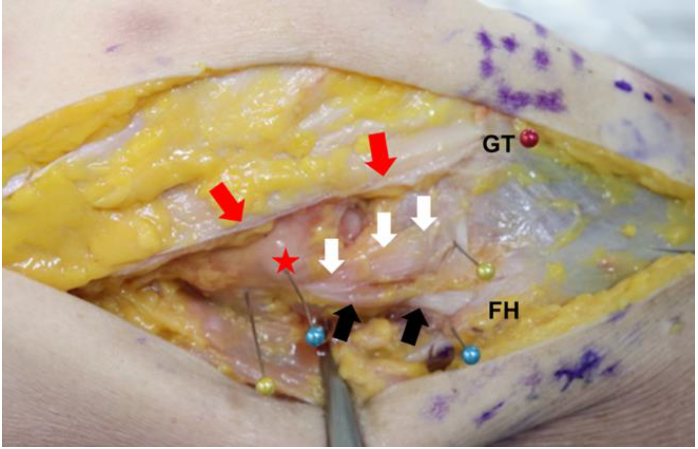 Medicina 58 00786 g001