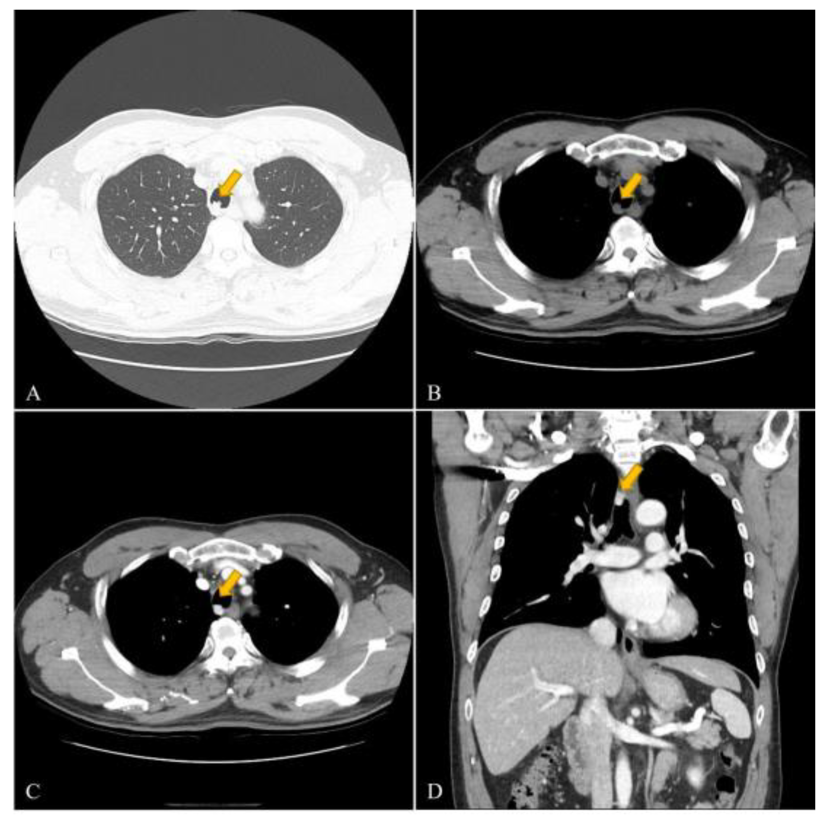 Medicina 58 00791 g001