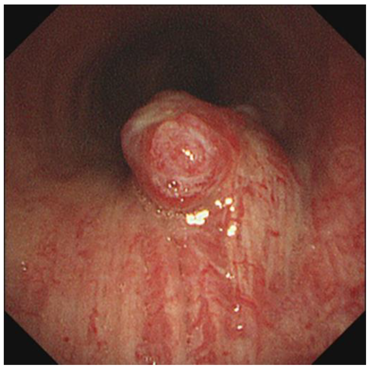 Medicina 58 00791 g002