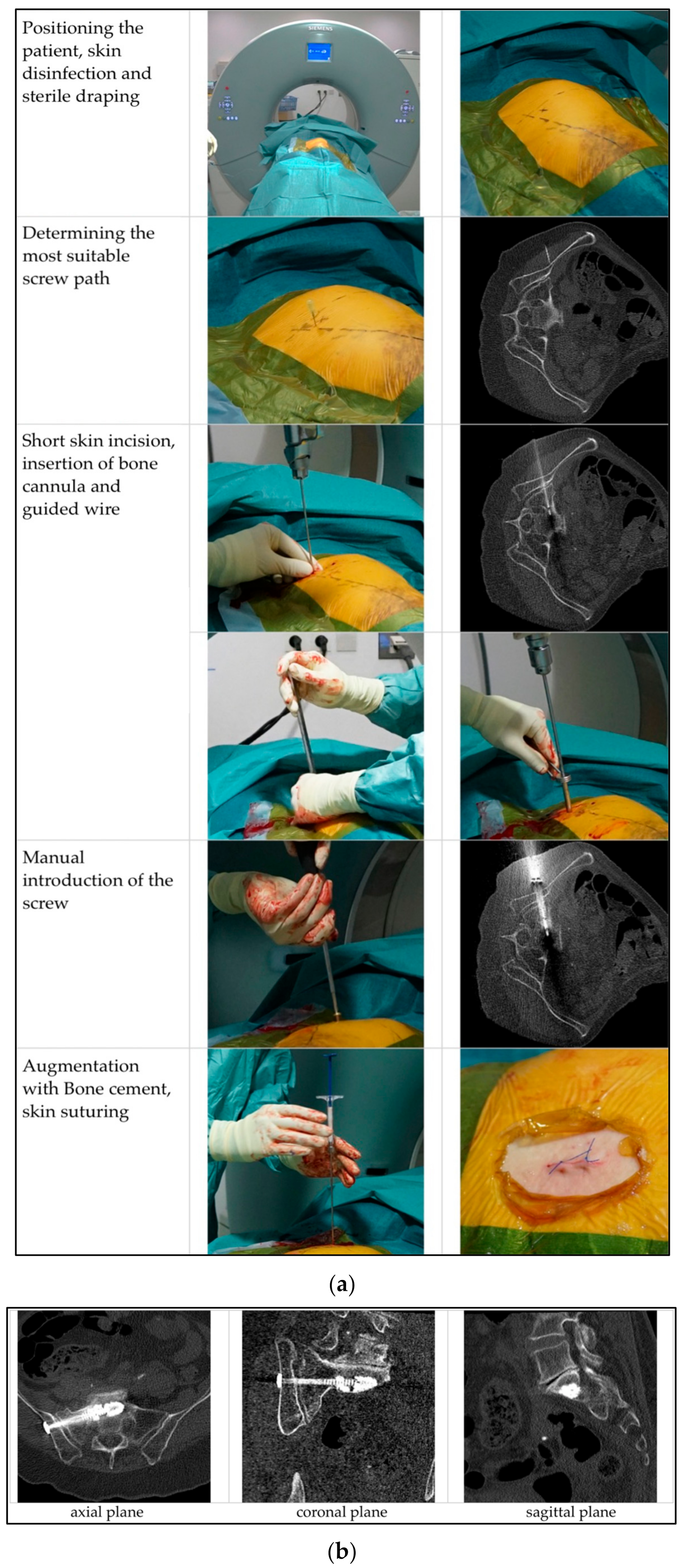 Medicina 58 00809 g002 550