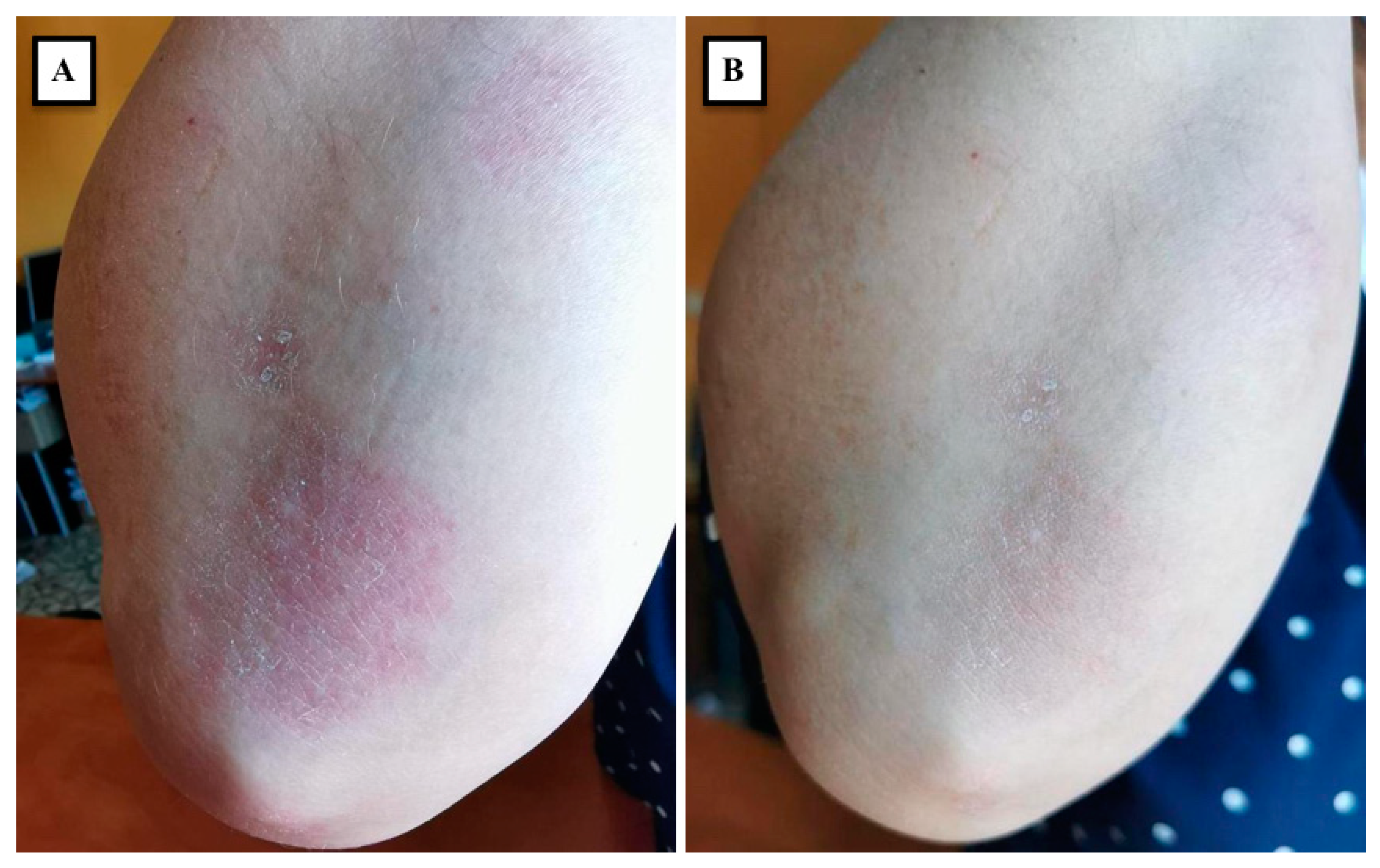 Medicina 58 00813 g001