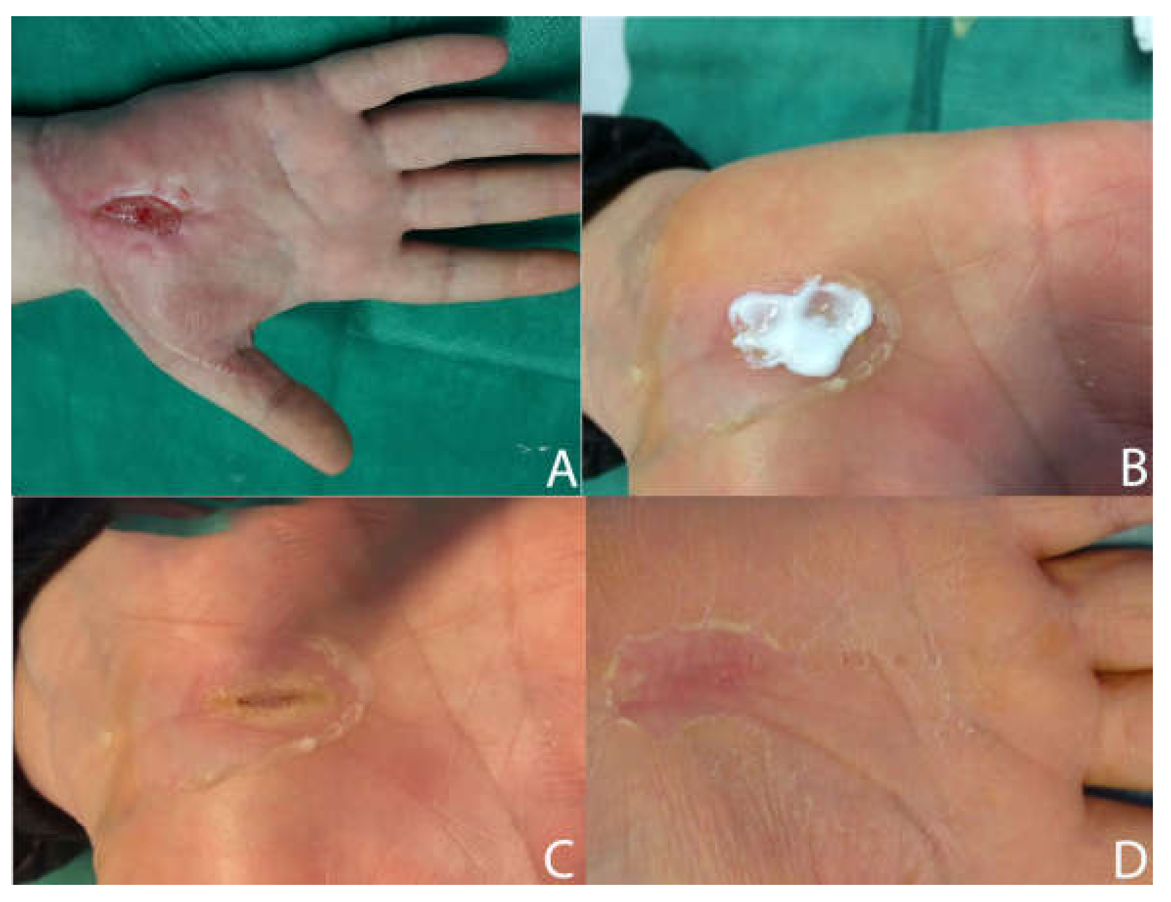 Medicina 58 00835 g005