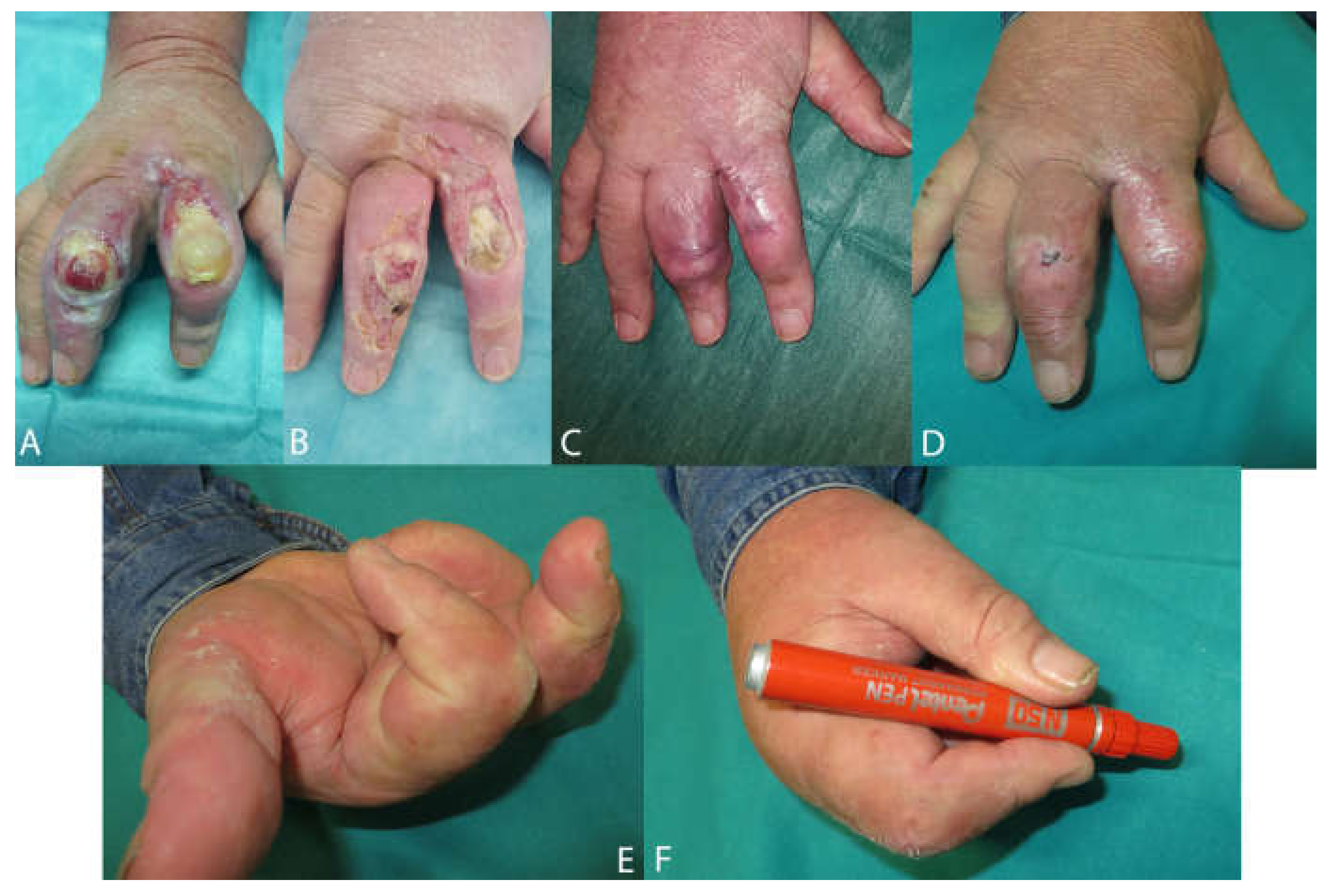 Medicina 58 00835 g007