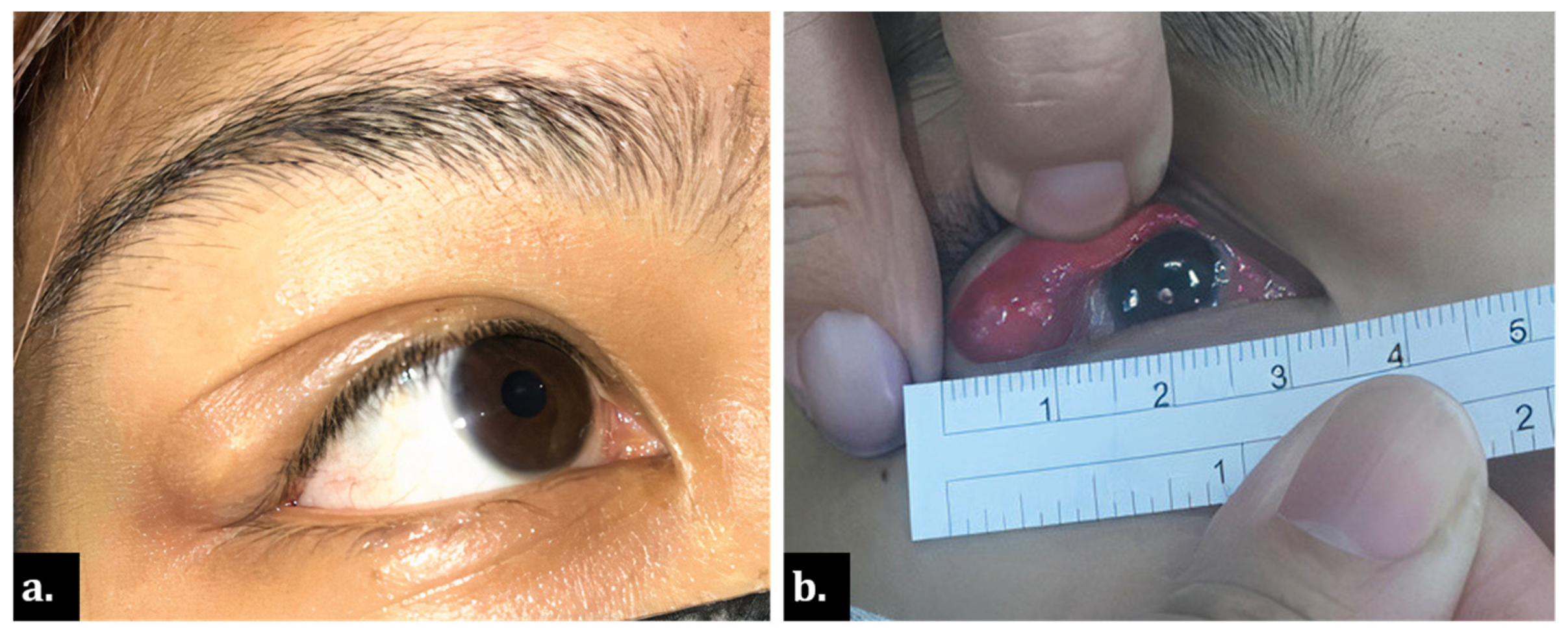 Medicina 58 00840 g001