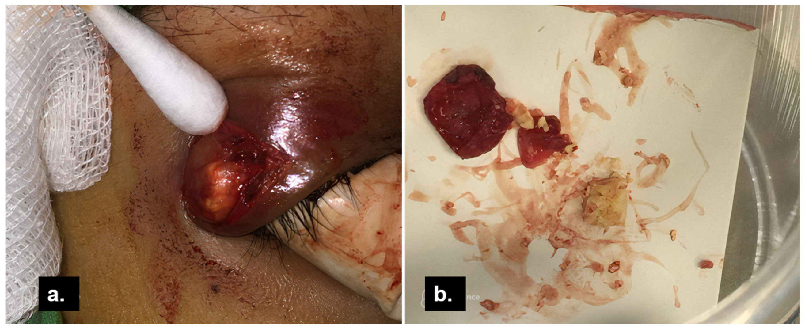 Medicina 58 00840 g003