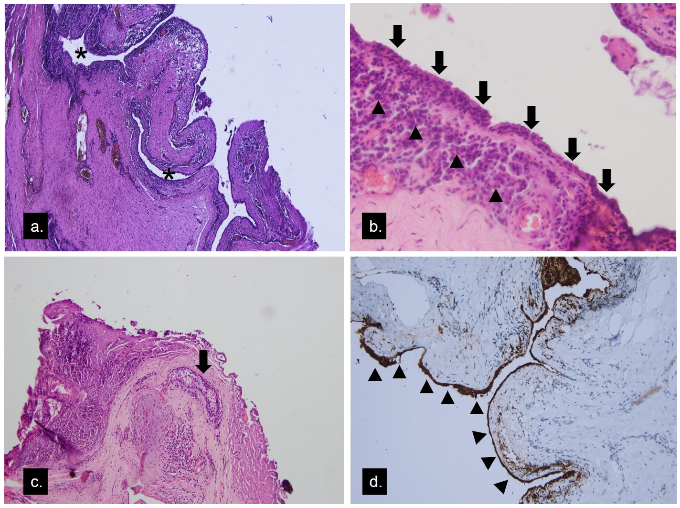 Medicina 58 00840 g004