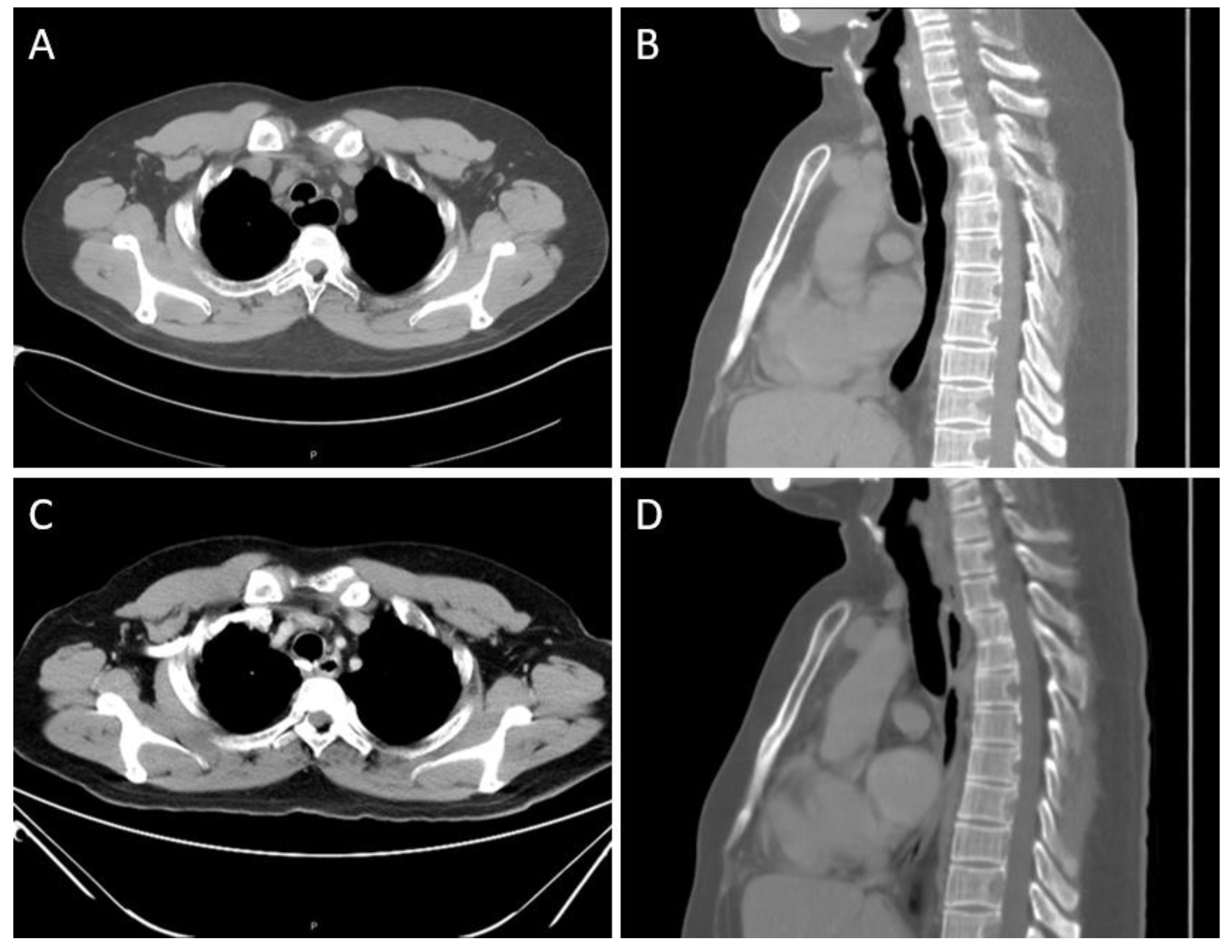 Medicina 58 00843 g001 550