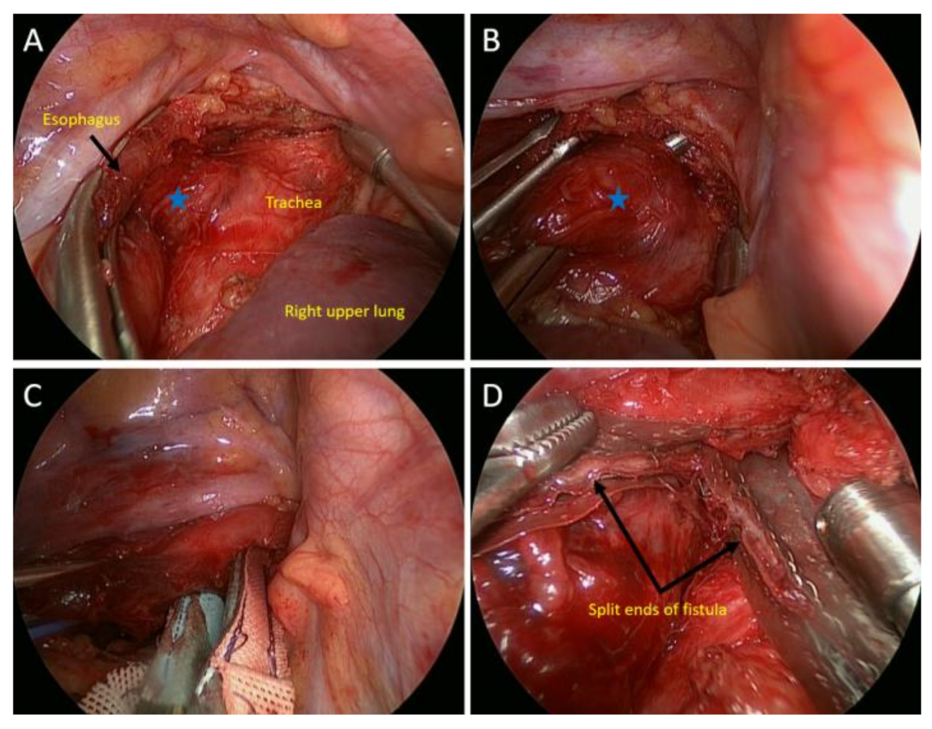 Medicina 58 00843 g003 550