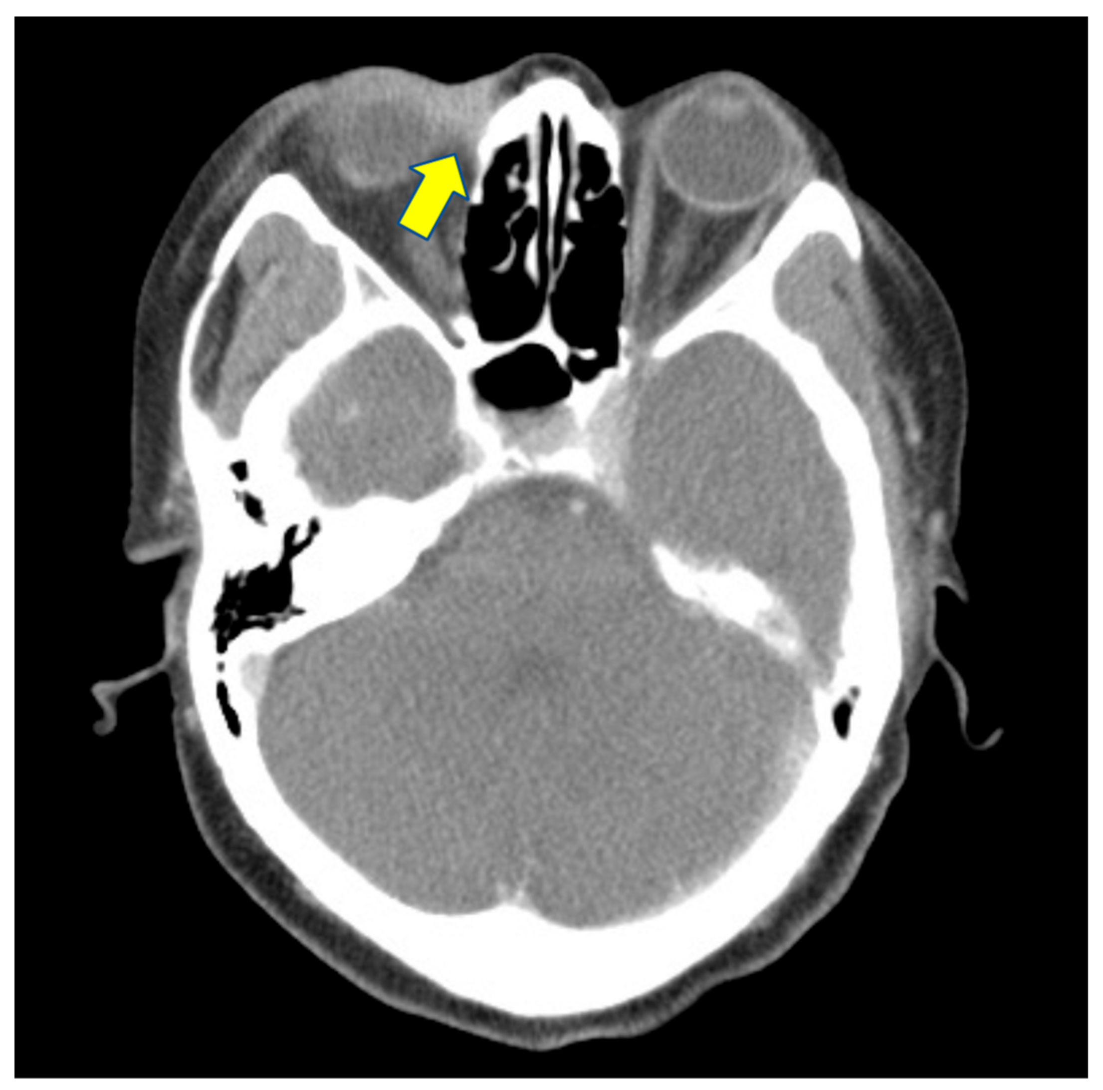 Medicina 58 00846 g002 550