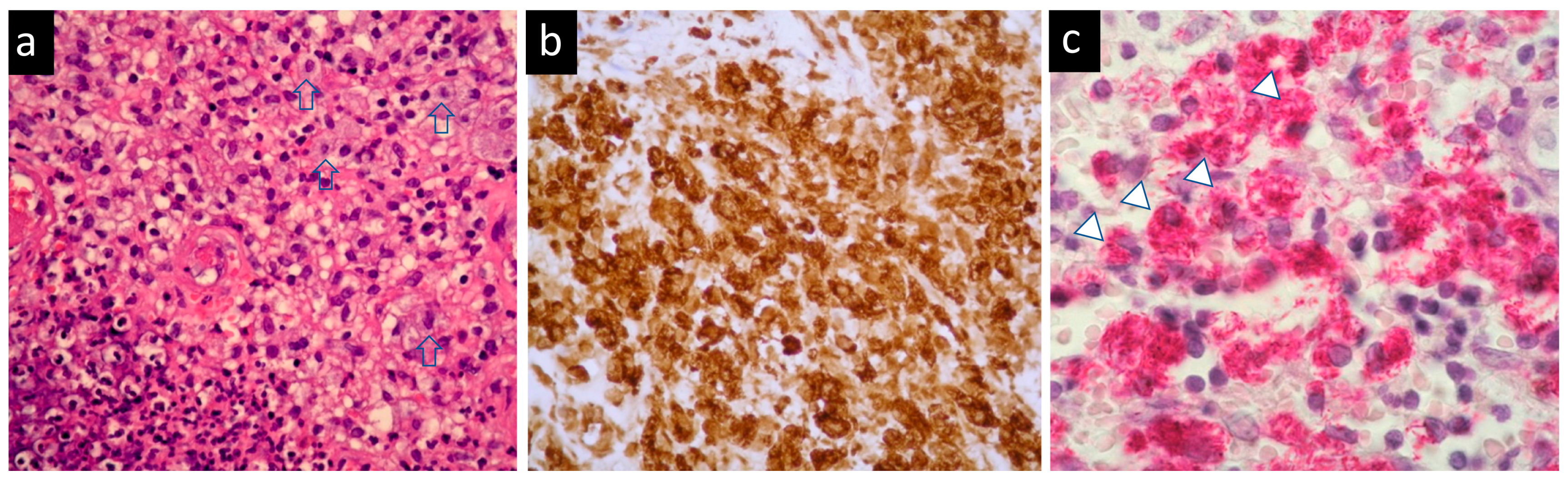 Medicina 58 00846 g003 550