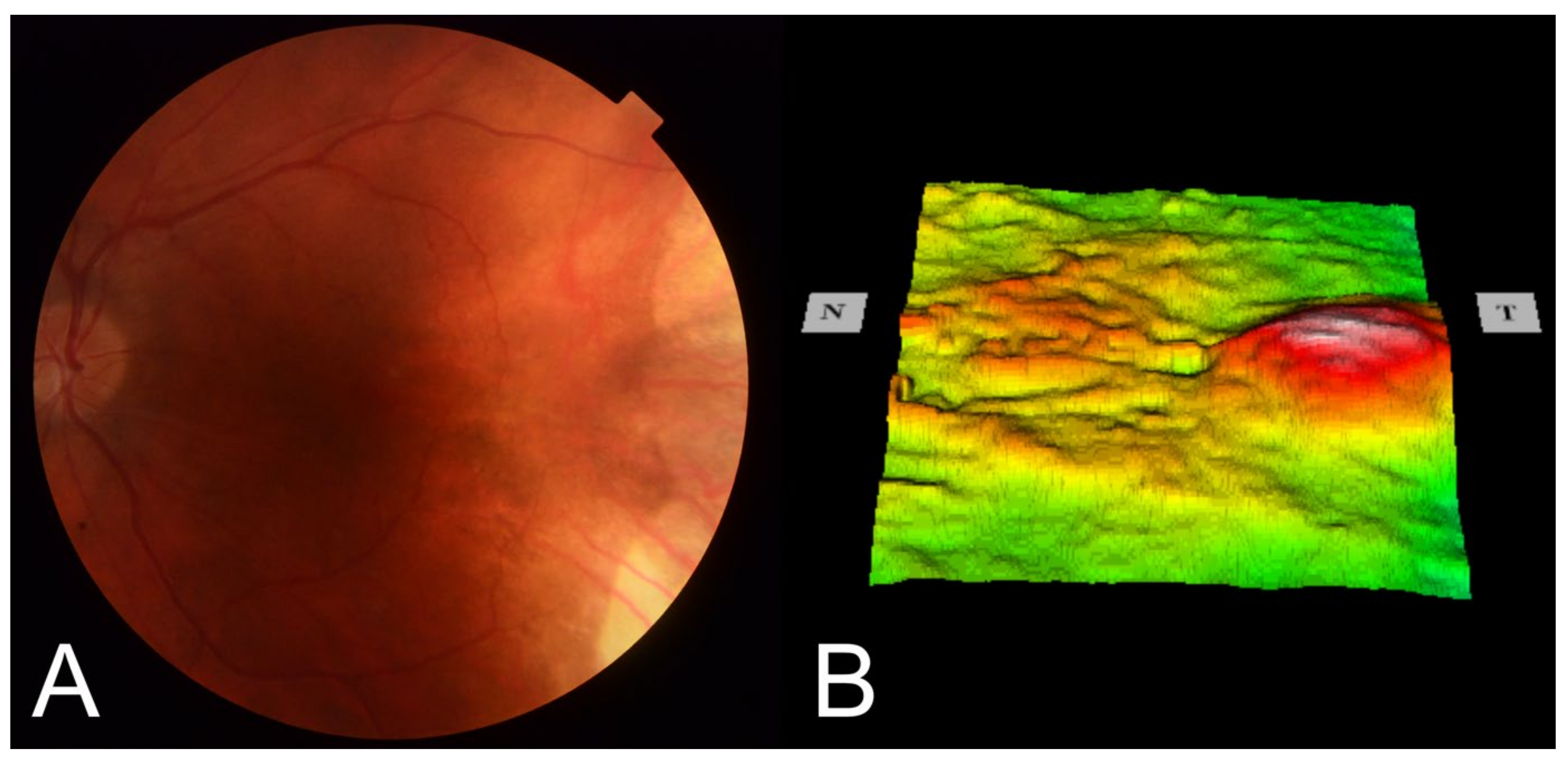 Medicina 58 00862 g002