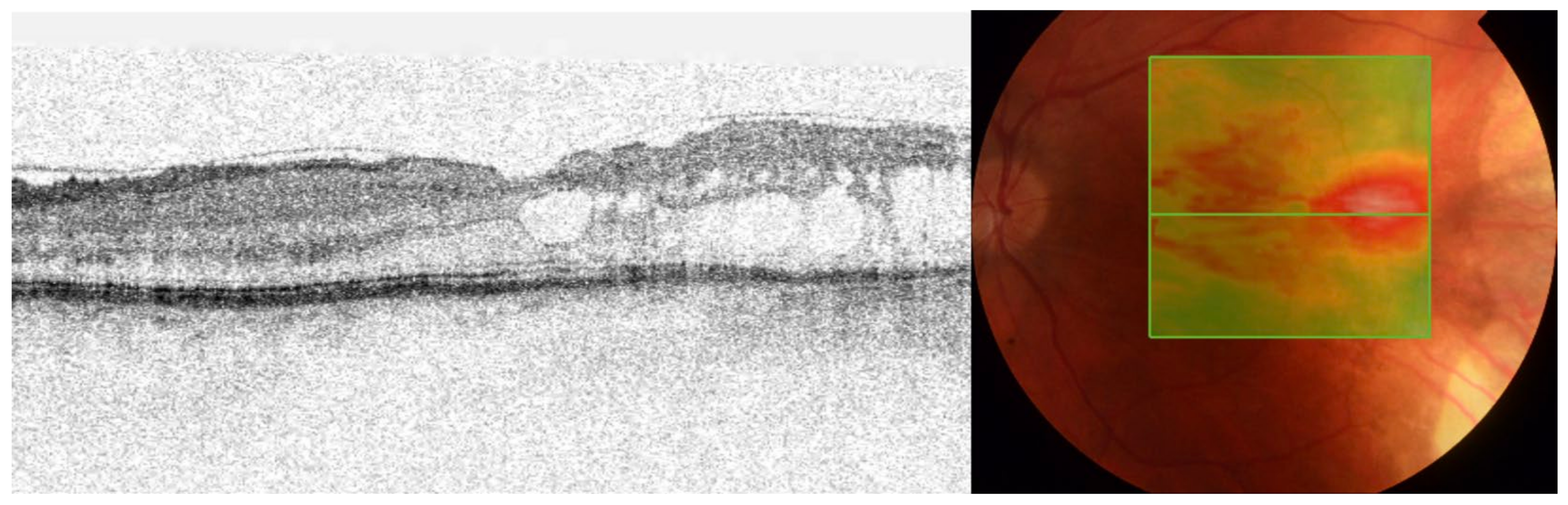 Medicina 58 00862 g003