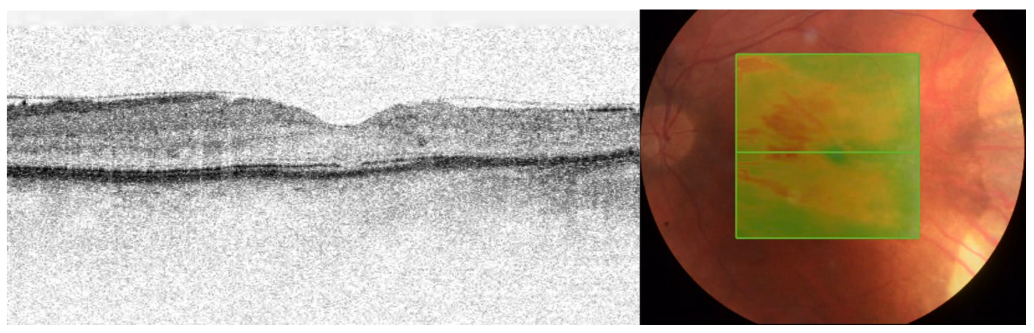 Medicina 58 00862 g004