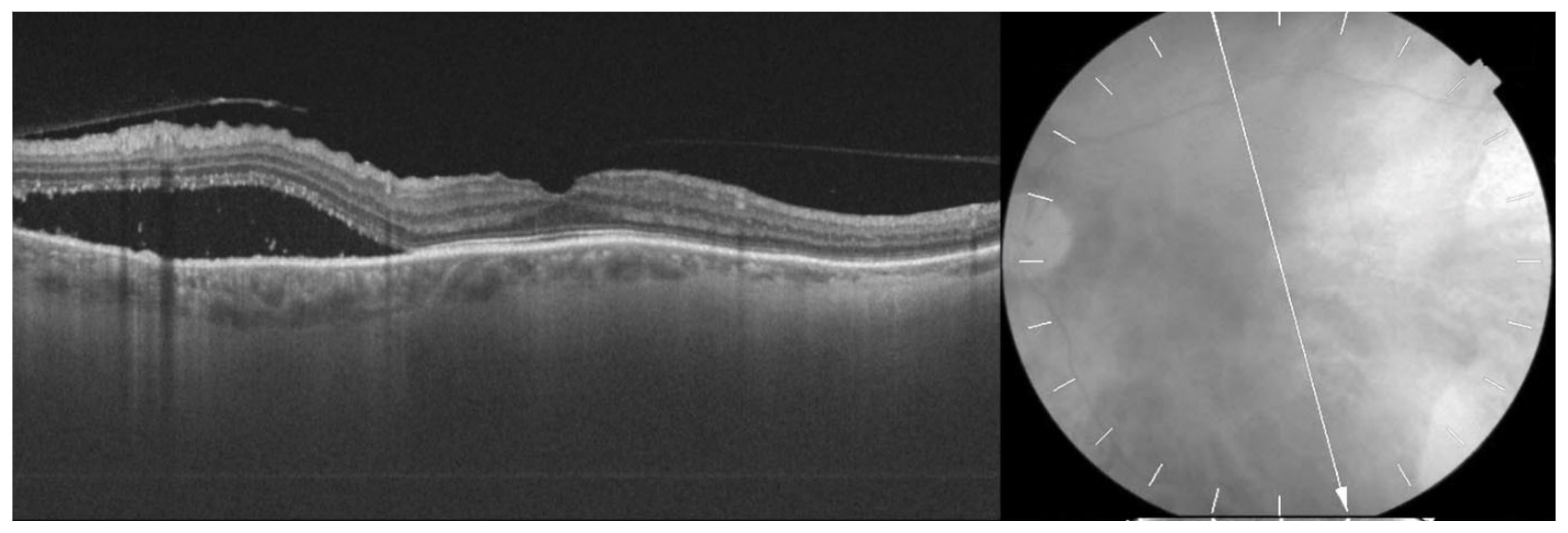 Medicina 58 00862 g005