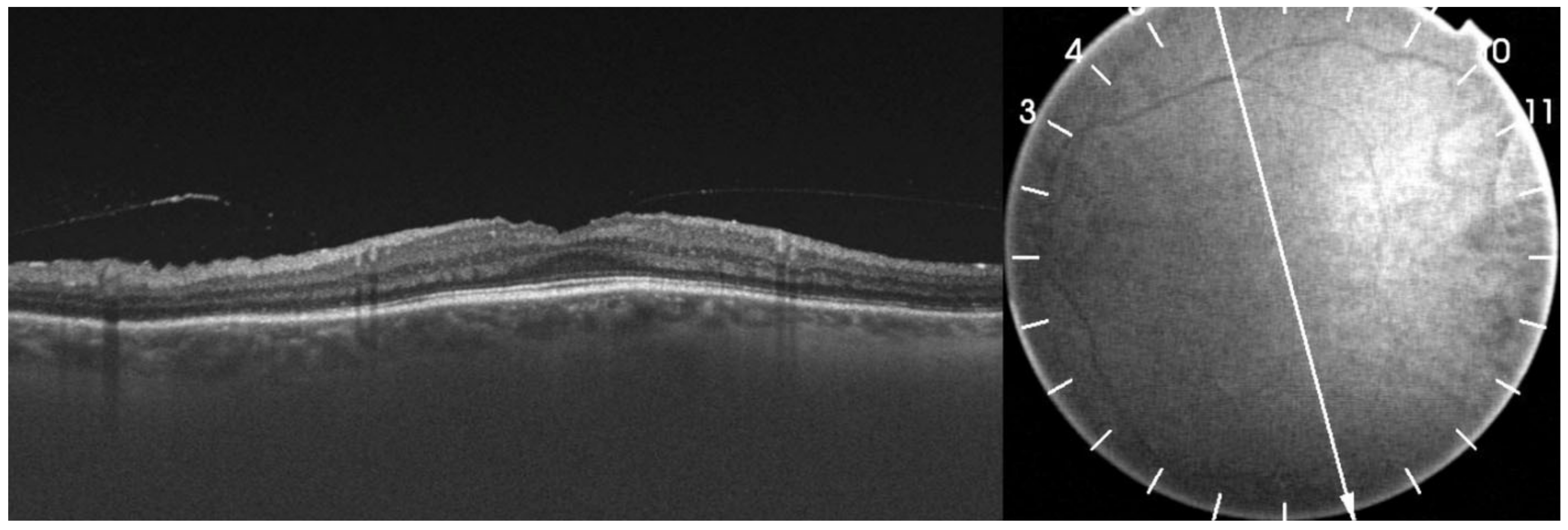 Medicina 58 00862 g008