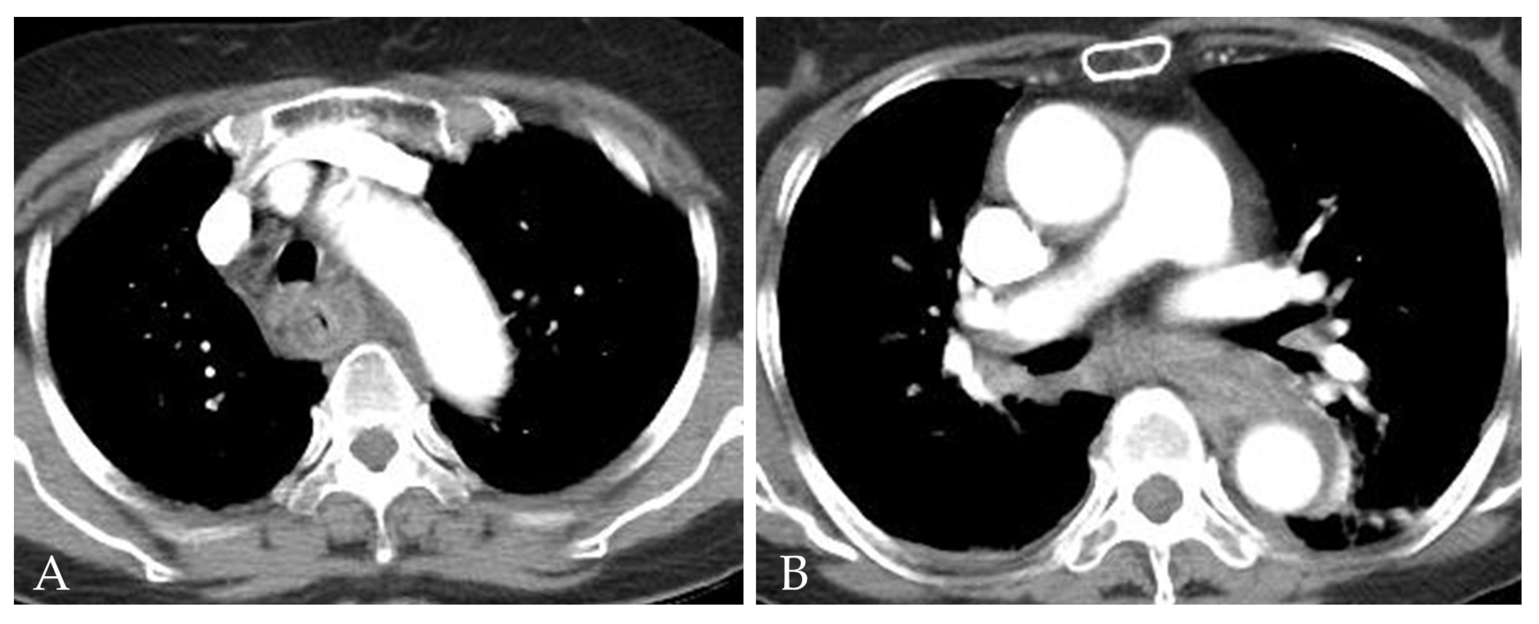 Medicina 58 00864 g001 Medicina 58 00864 g001