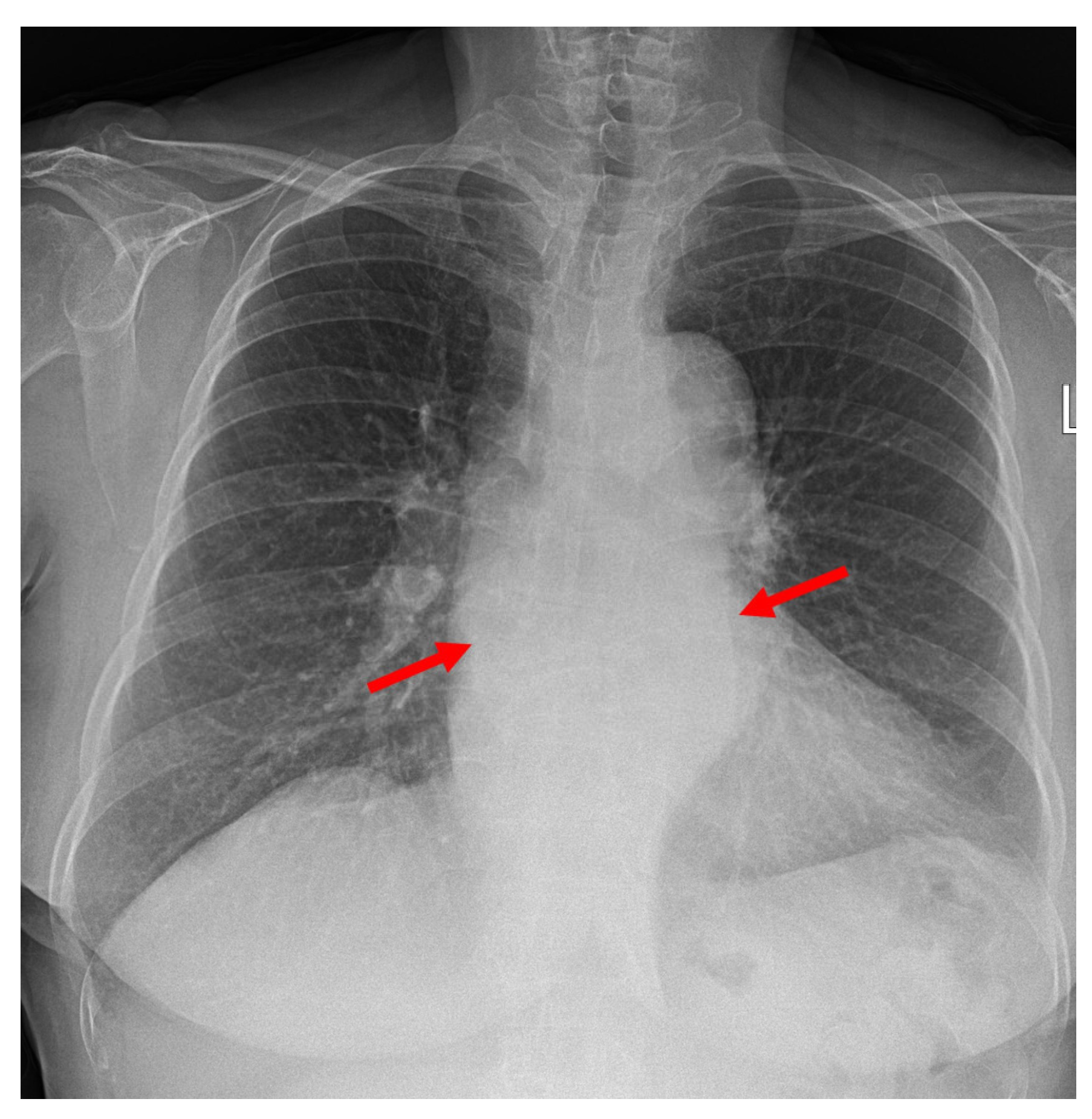 Medicina 58 00864 g003 Medicina 58 00864 g003
