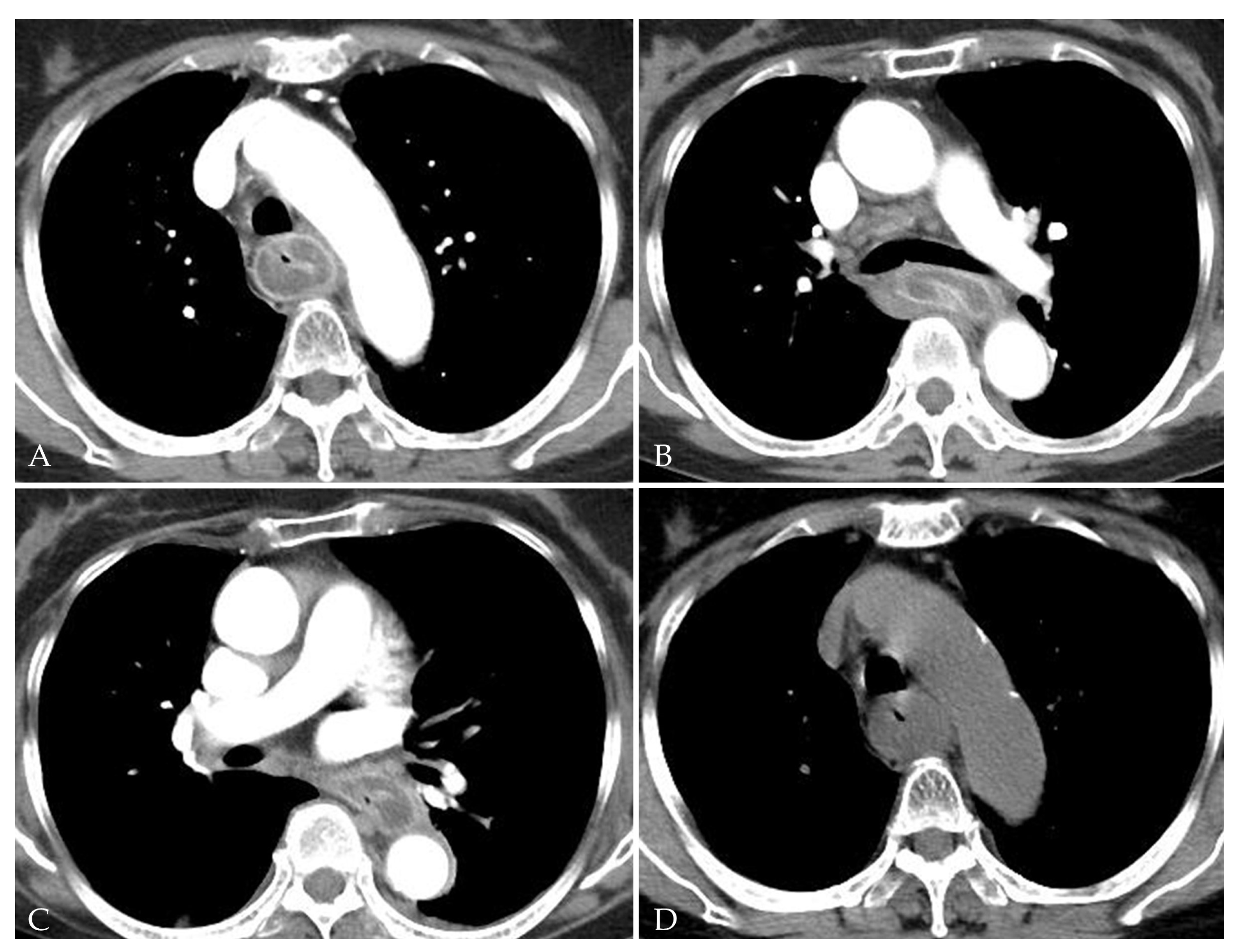 Medicina 58 00864 g004 Medicina 58 00864 g004