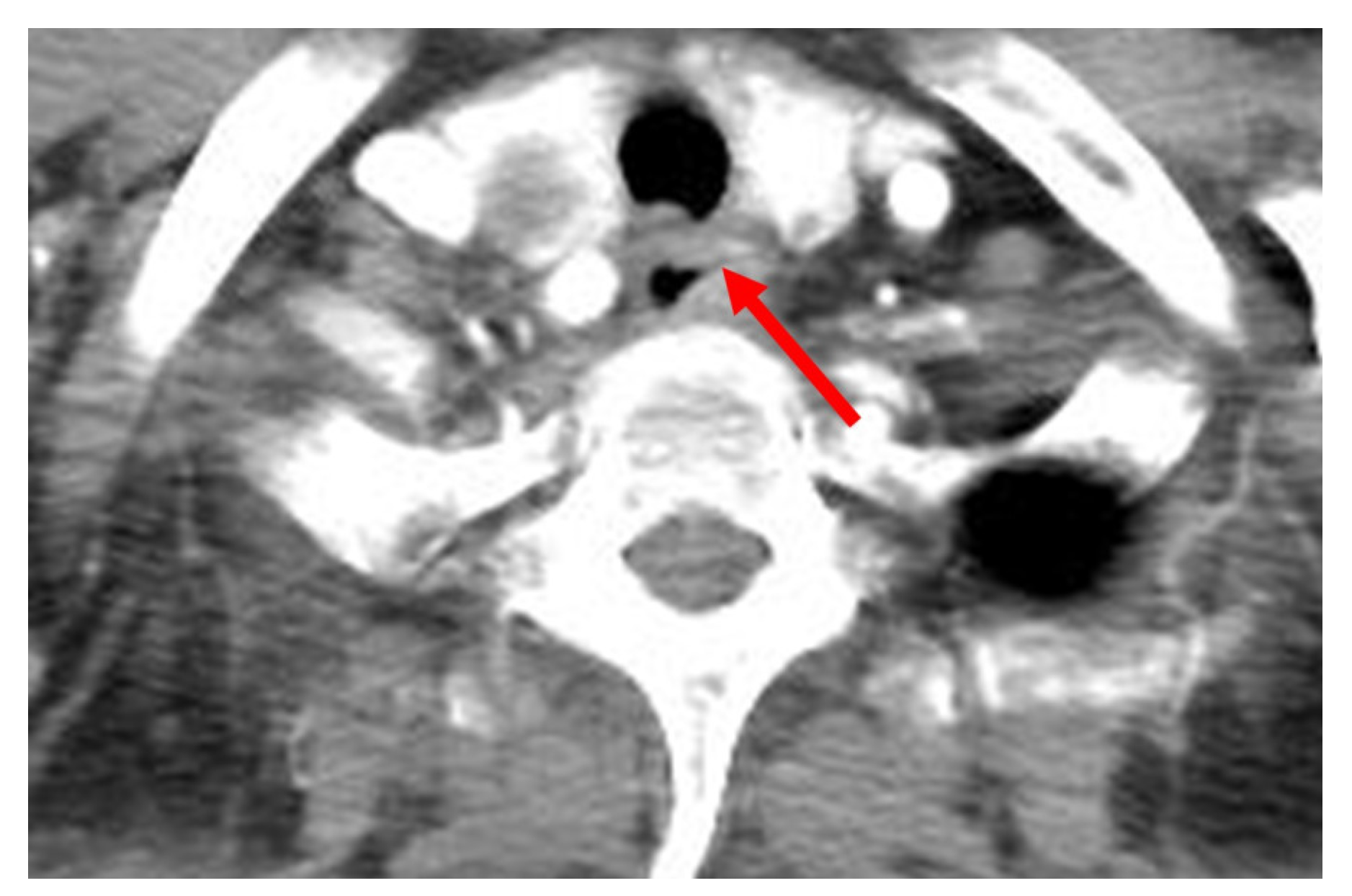 Medicina 58 00864 g005 Medicina 58 00864 g005