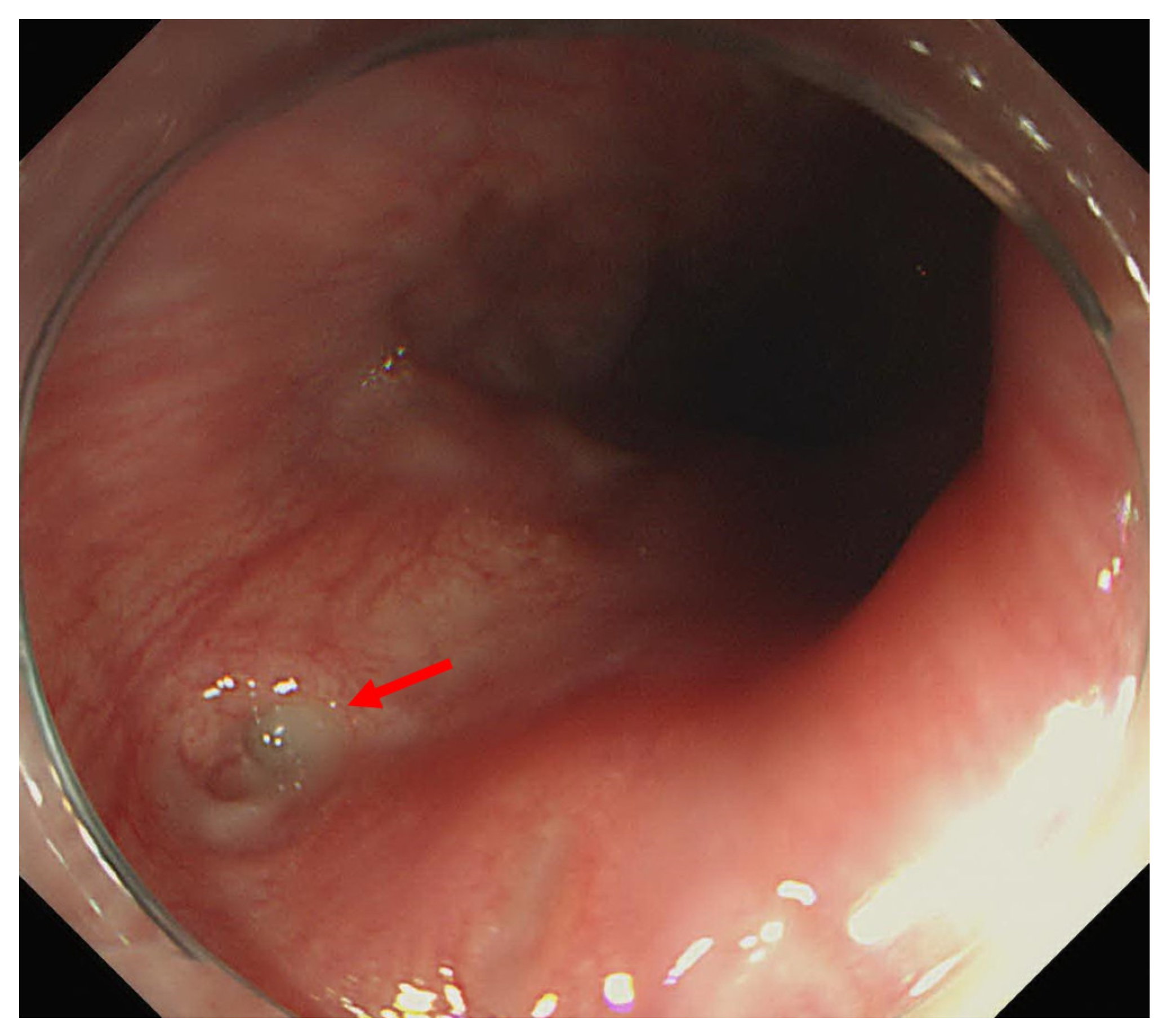 Medicina 58 00864 g006 Medicina 58 00864 g006
