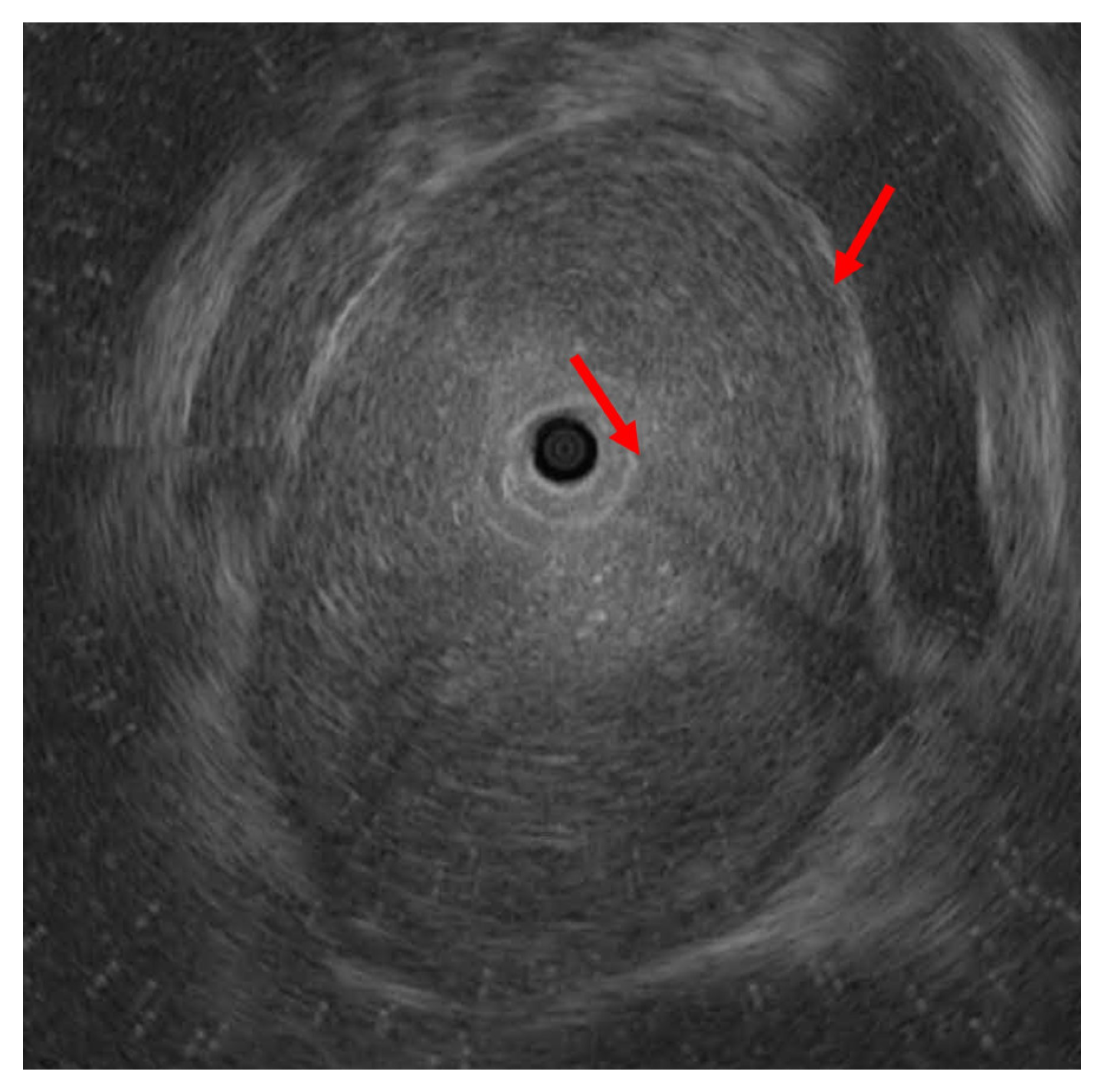 Medicina 58 00864 g007 Medicina 58 00864 g007