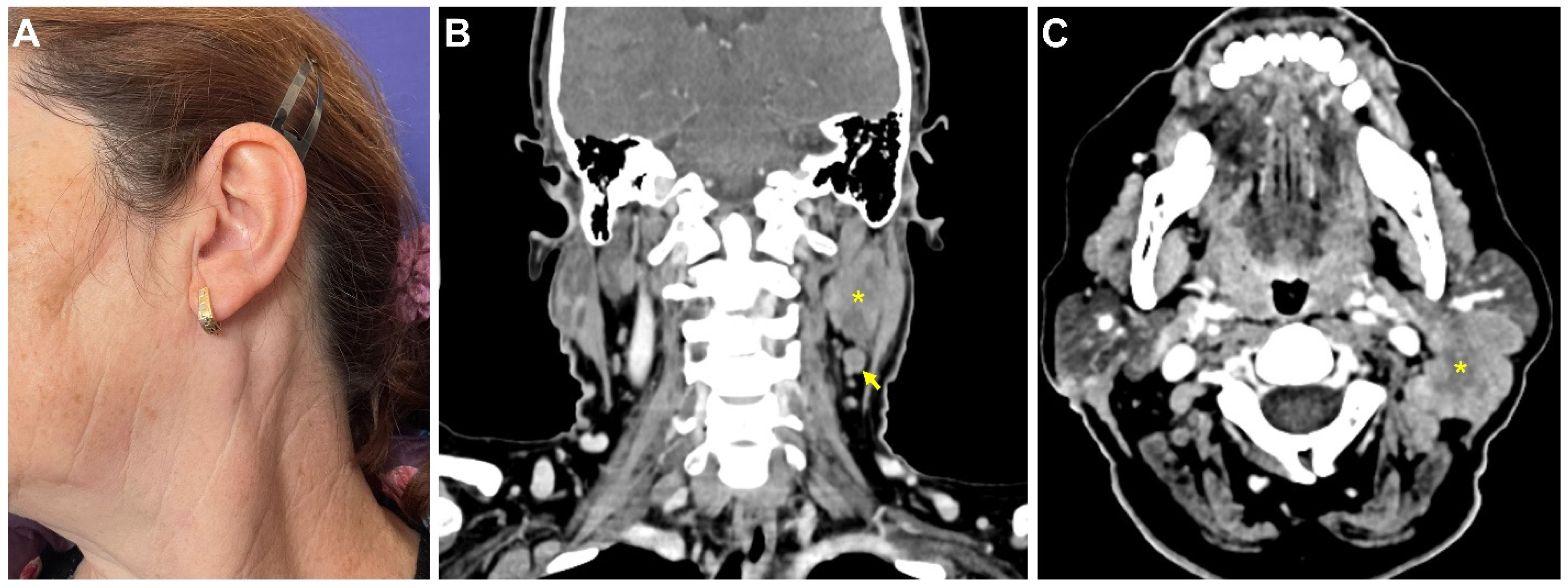 Medicina 58 00874 g001 550