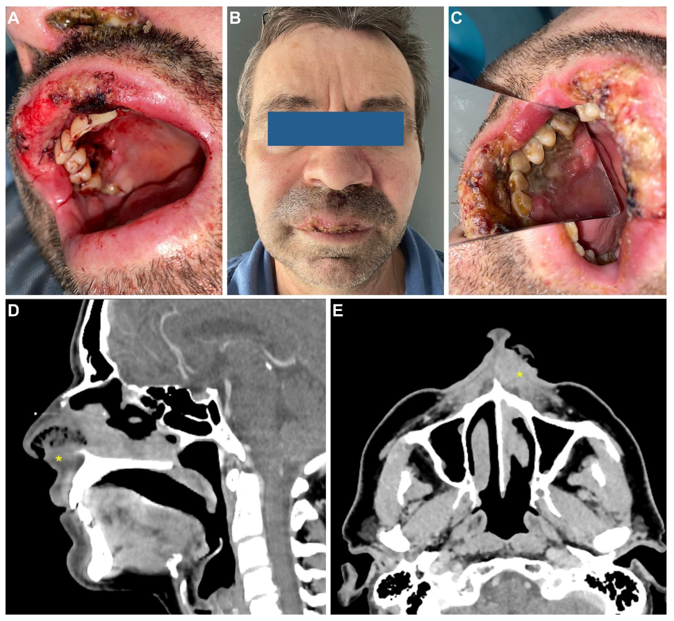 Medicina 58 00874 g003 550