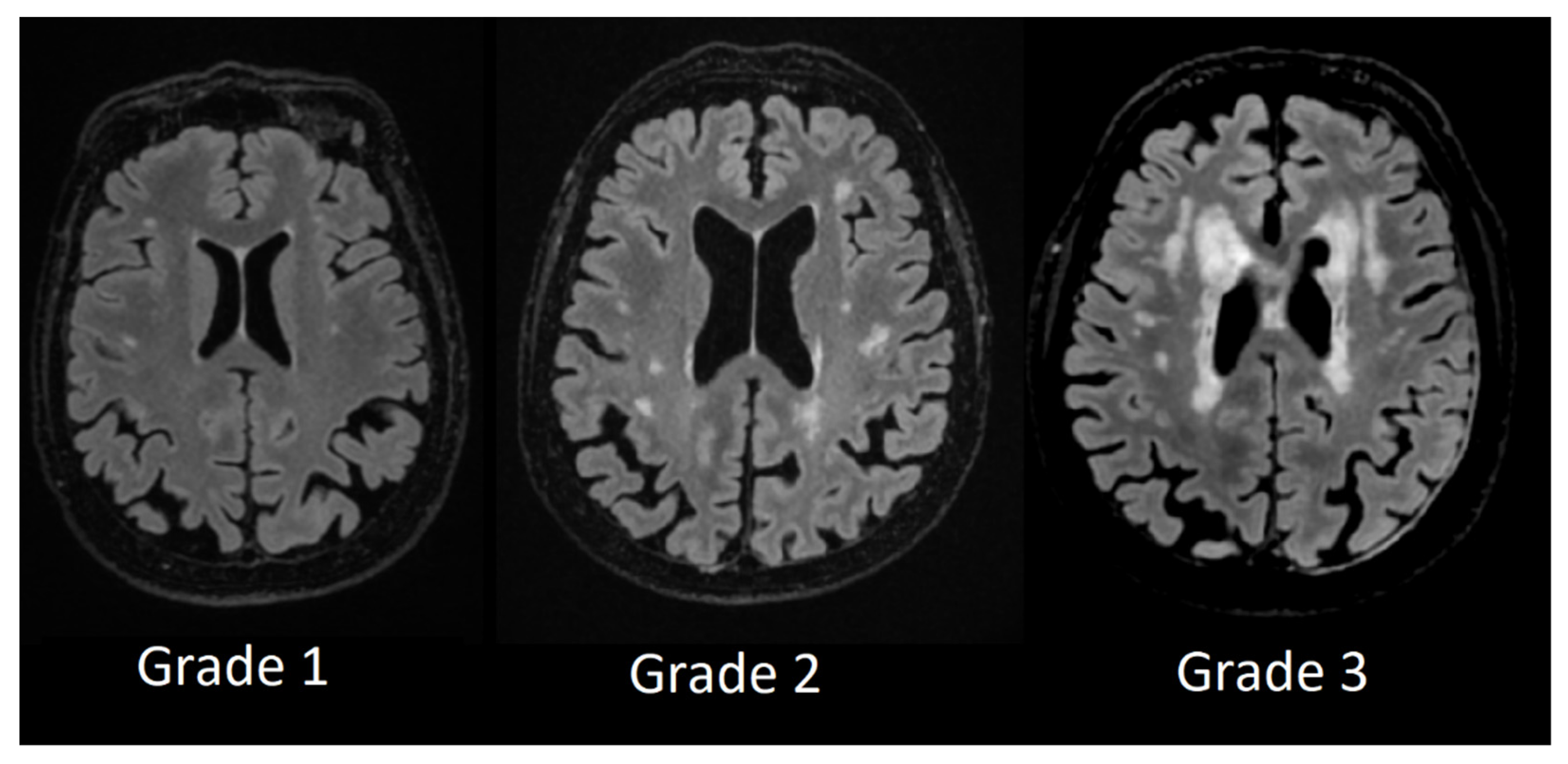 Medicina 58 00887 g004