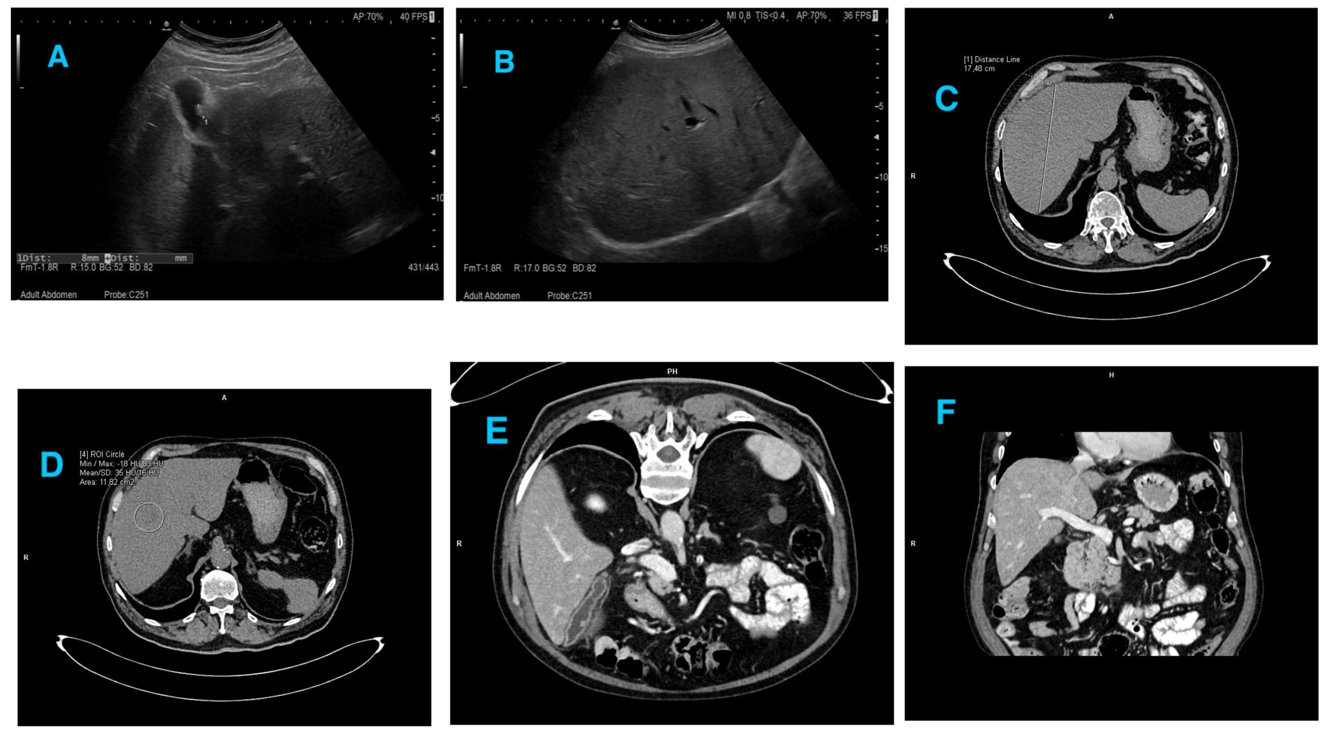 Medicina 58 00896 g0a1