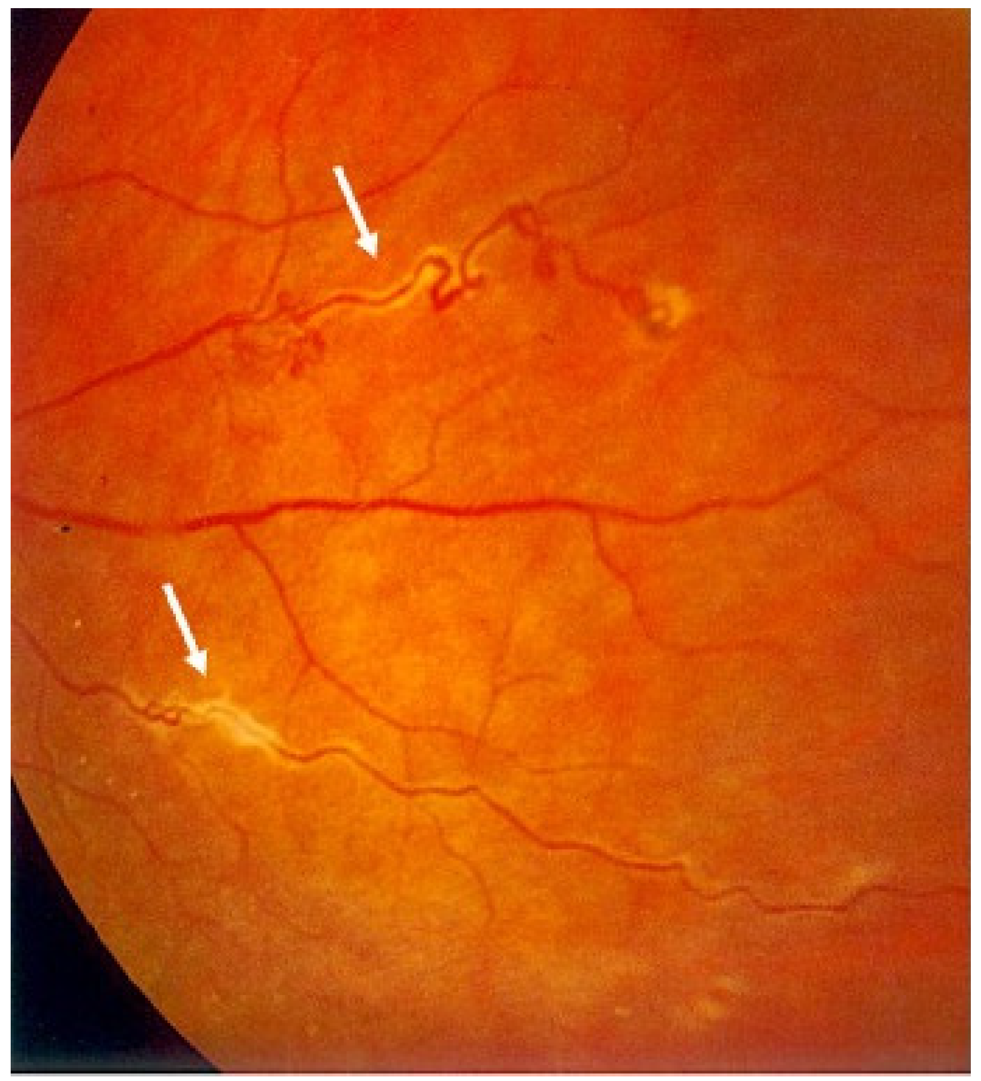 Medicina 58 00898 g003 Medicina 58 00898 g003