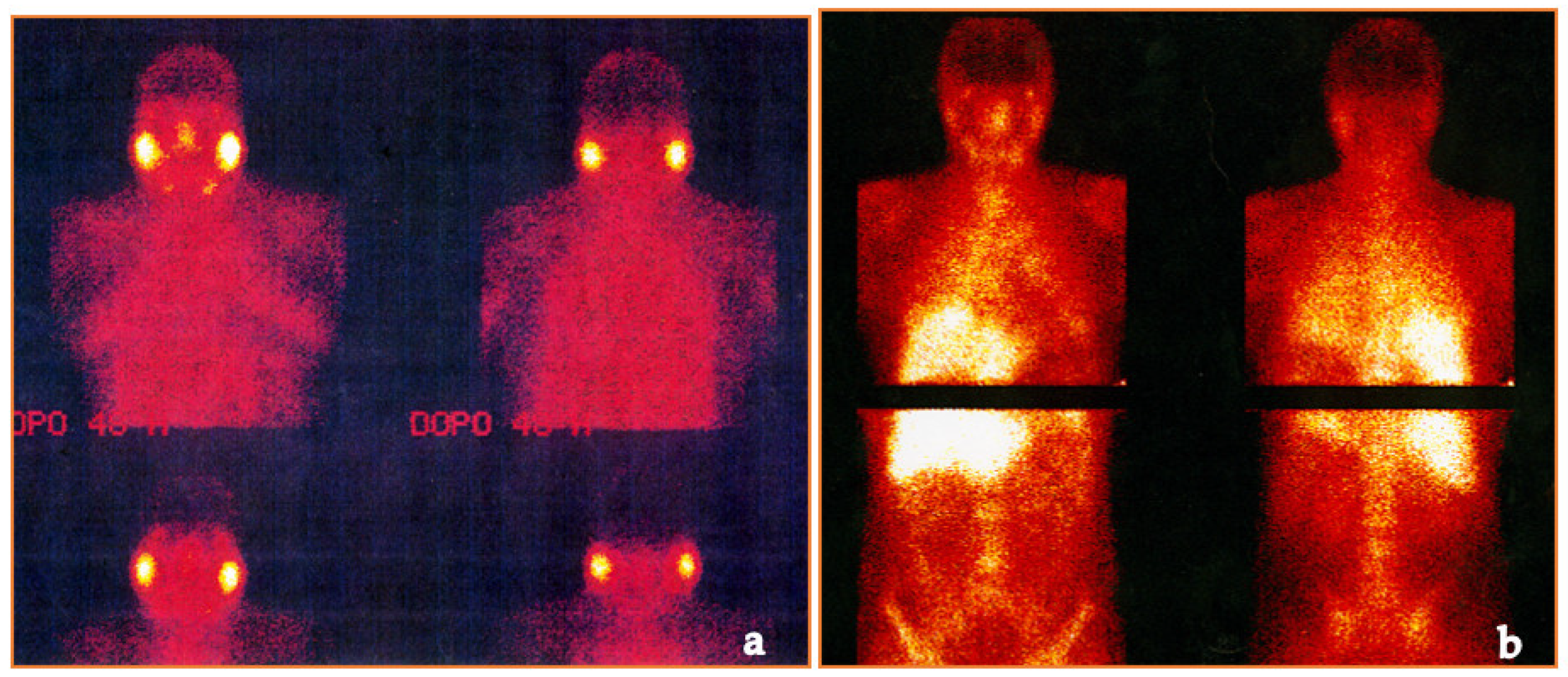 Medicina 58 00898 g006 Medicina 58 00898 g006