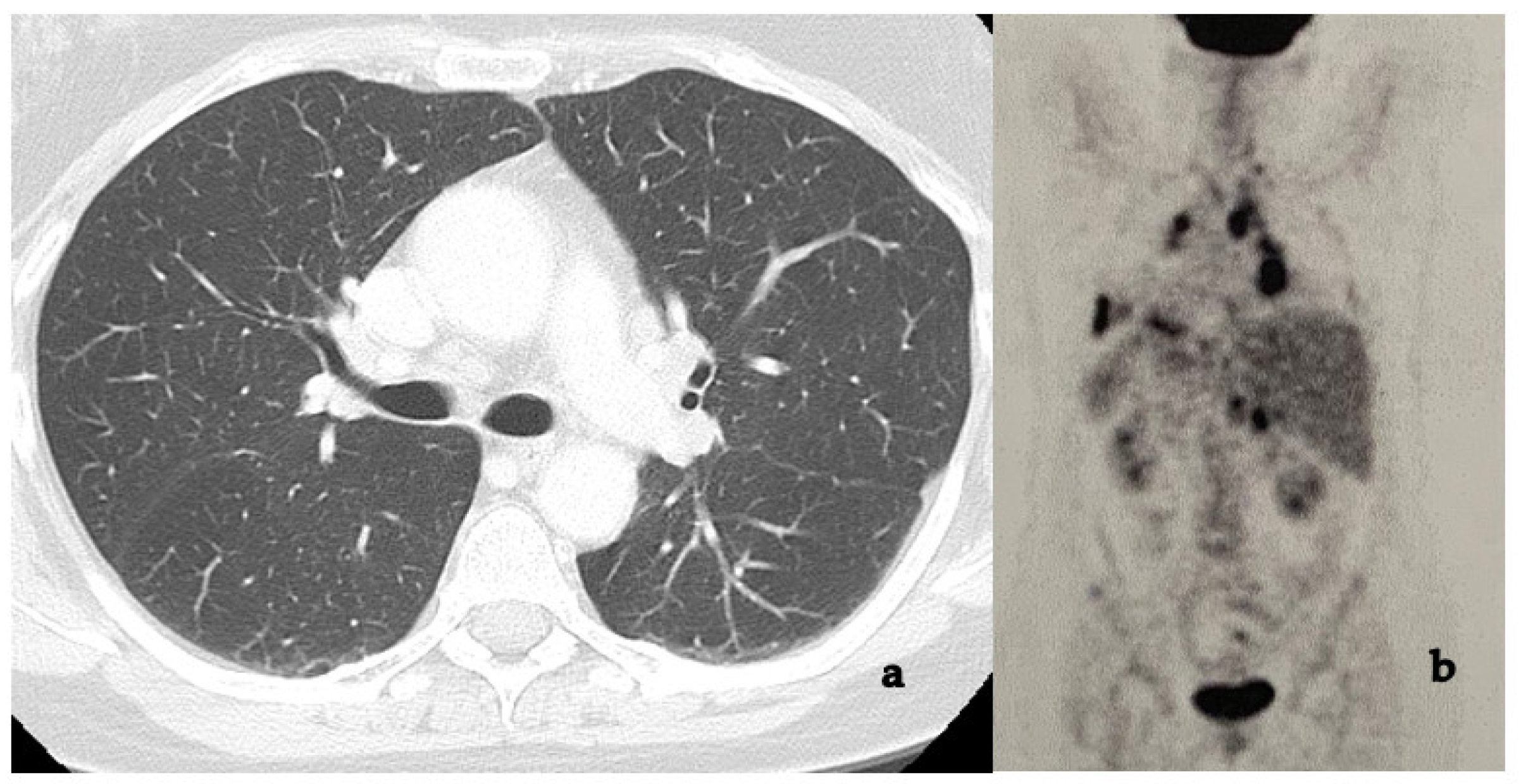 Medicina 58 00898 g012 Medicina 58 00898 g012