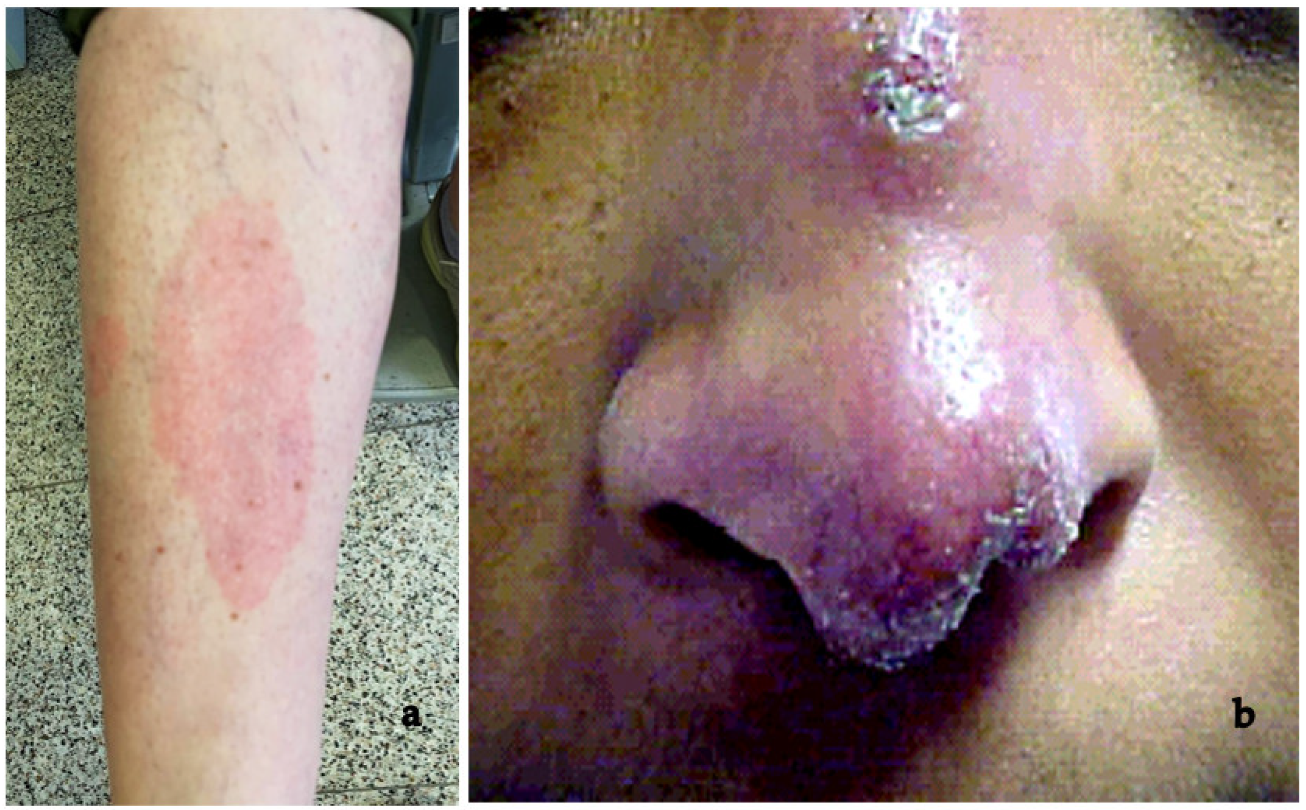 Medicina 58 00898 g013 Medicina 58 00898 g013