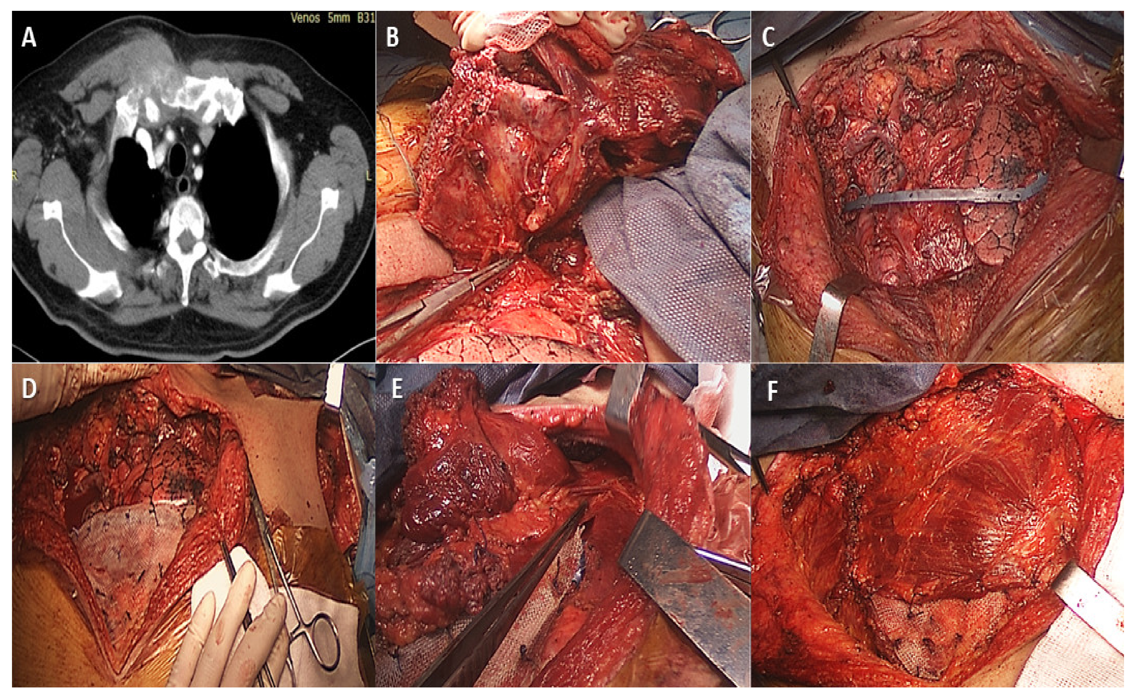 Medicina 58 00910 g004