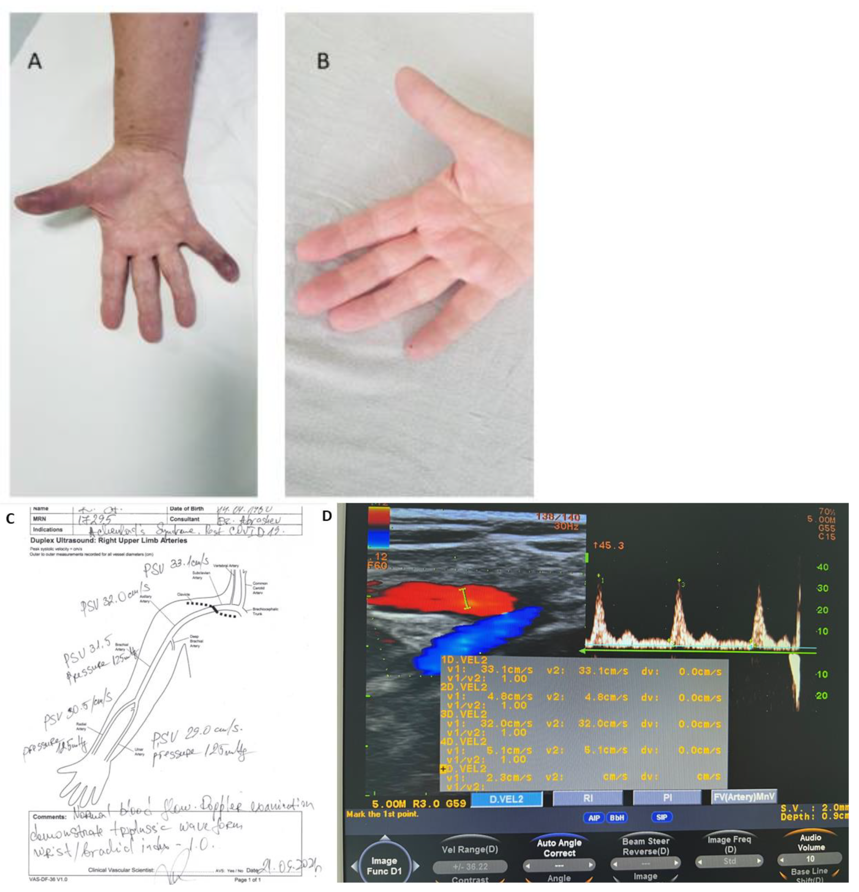 Medicina 58 00915 g002 550