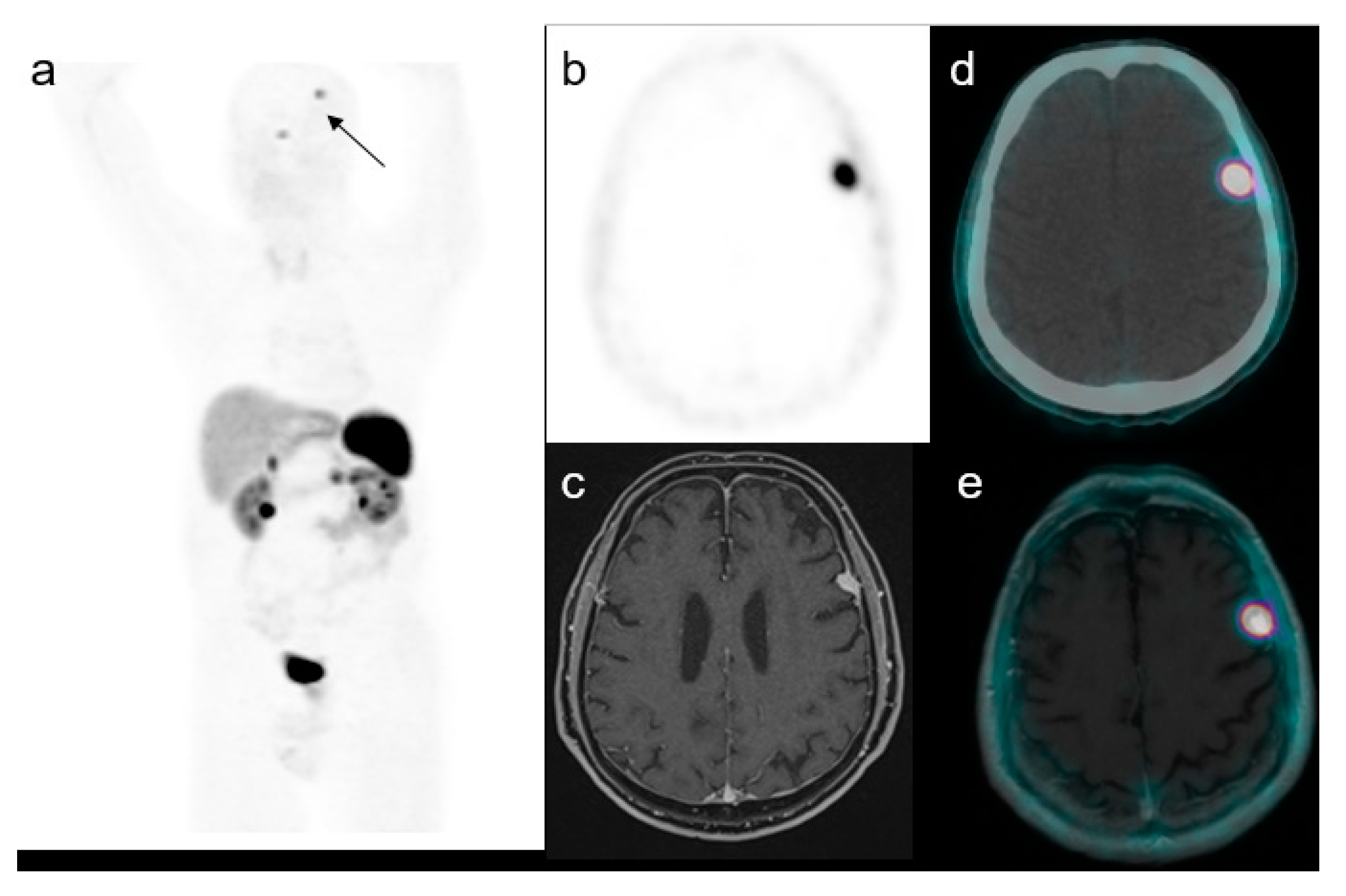 Medicina 58 00916 g002 550