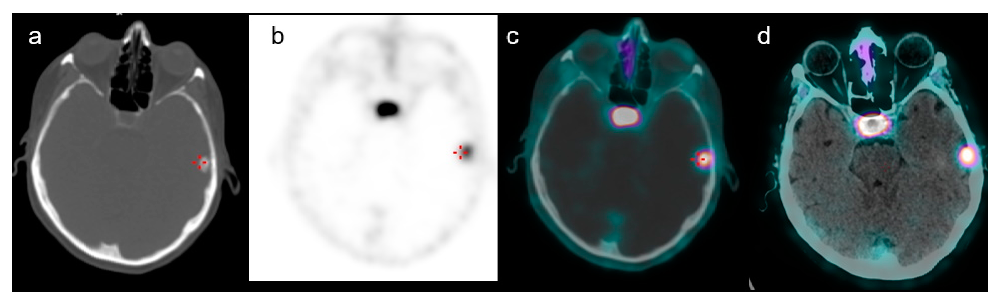 Medicina 58 00916 g003 550