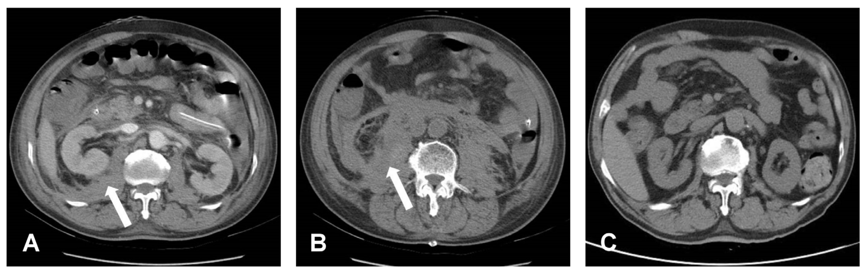 Medicina 58 00927 g003 550