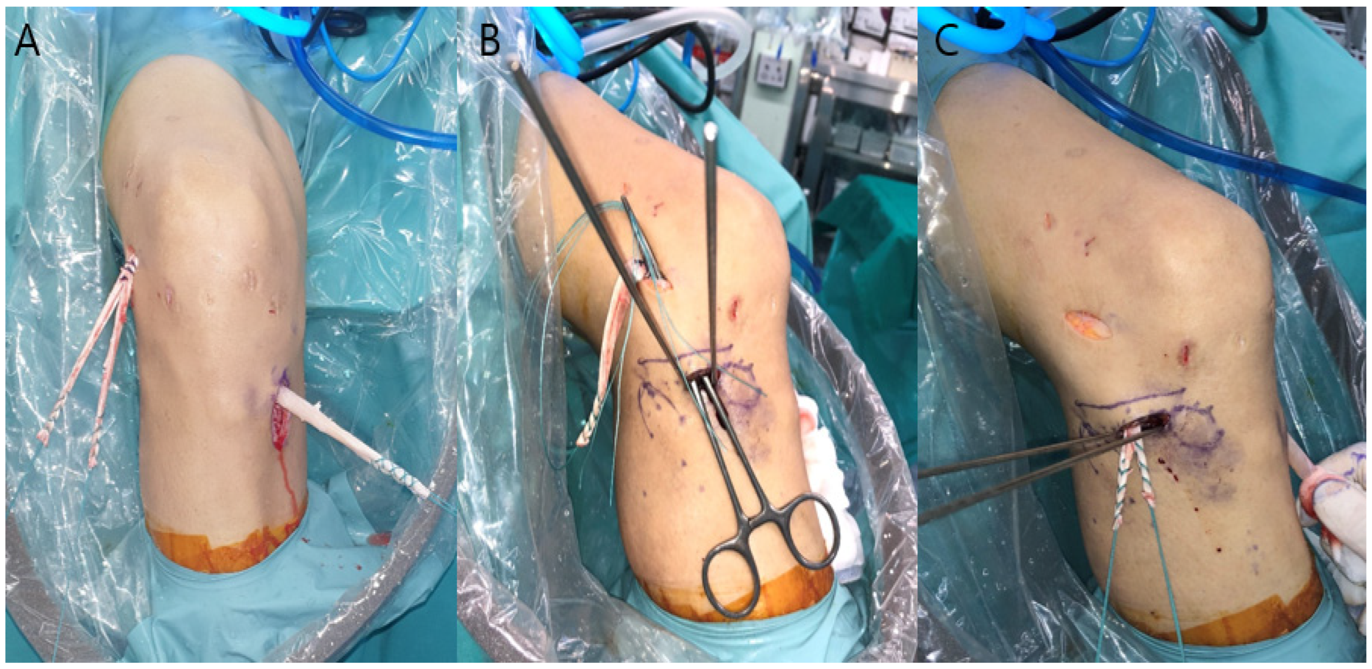 Medicina 58 00929 g003