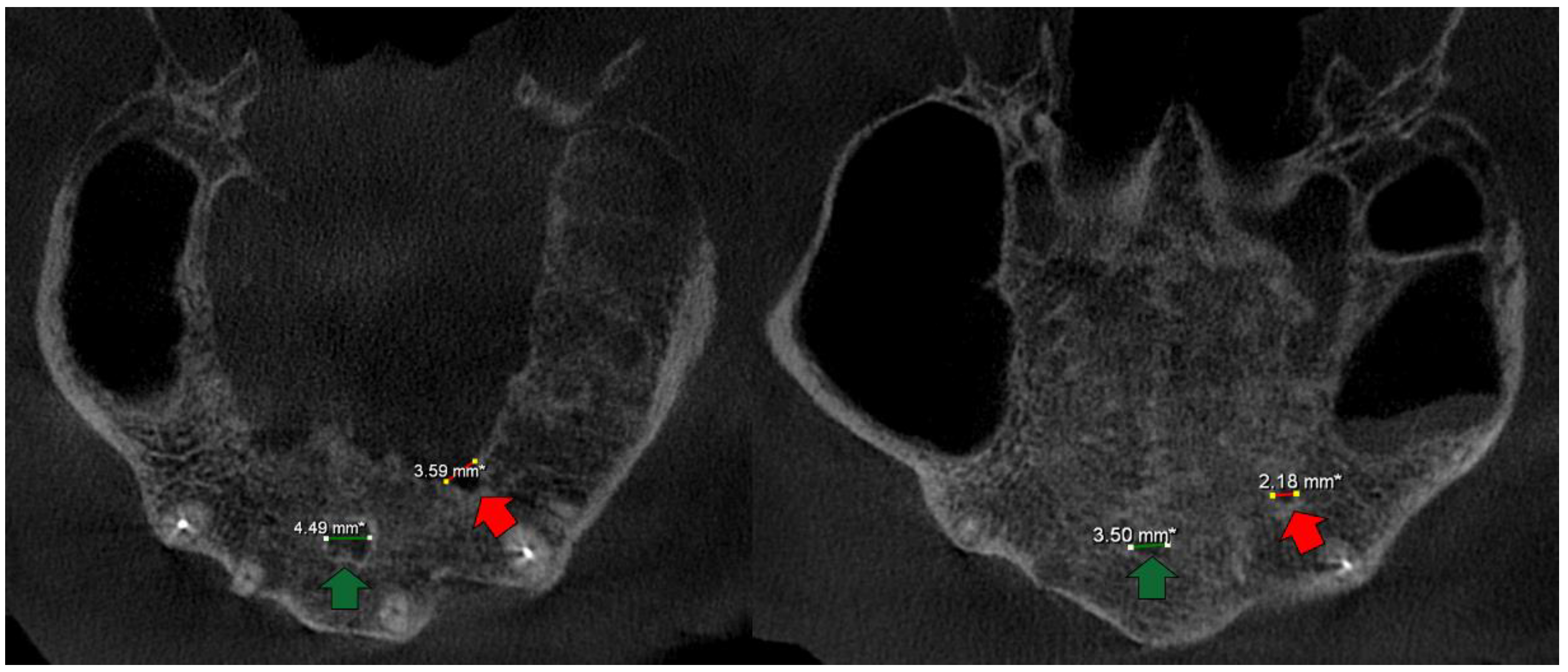 Medicina 58 00930 g004 550