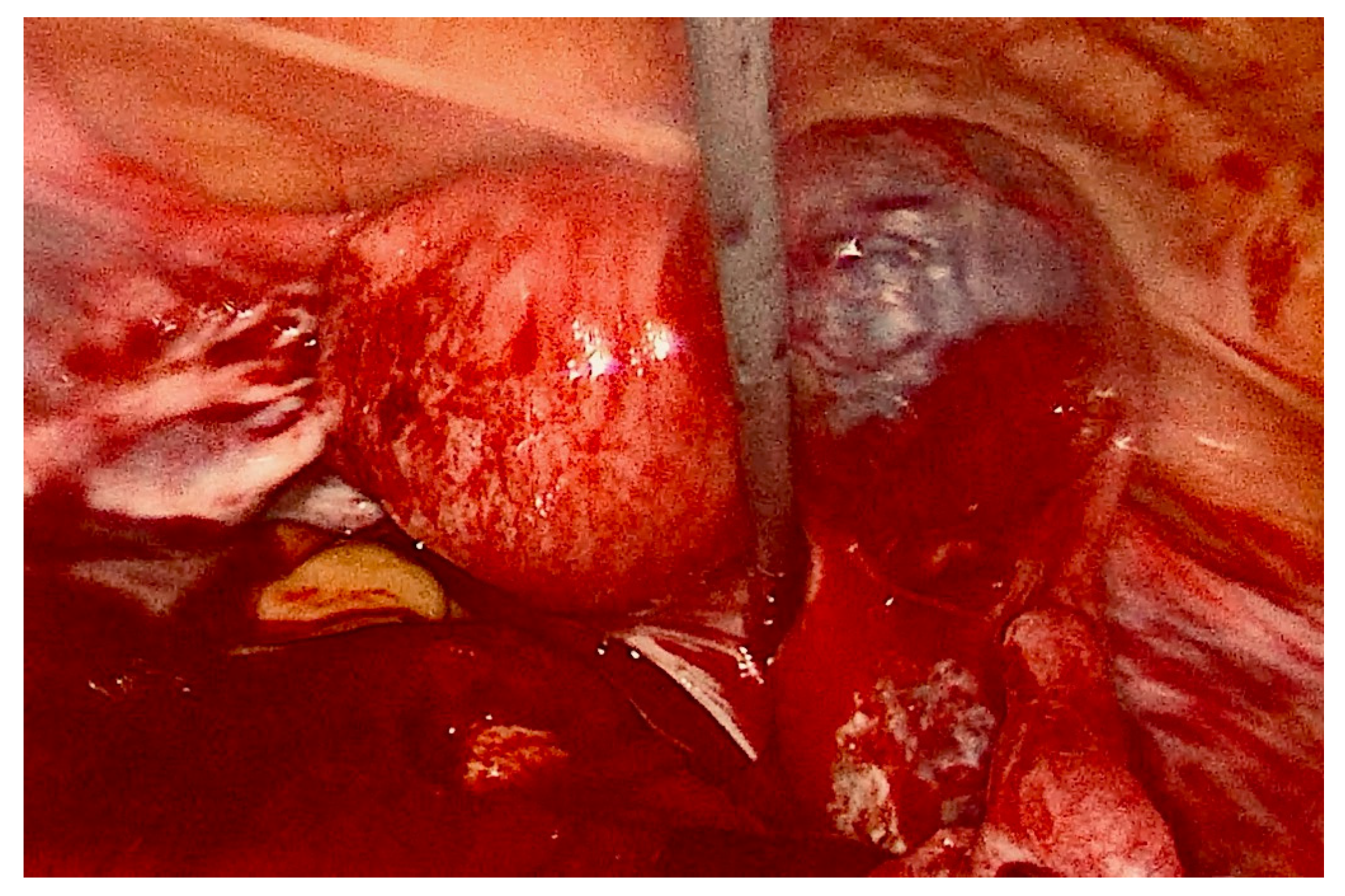 Medicina 58 00937 g003 550