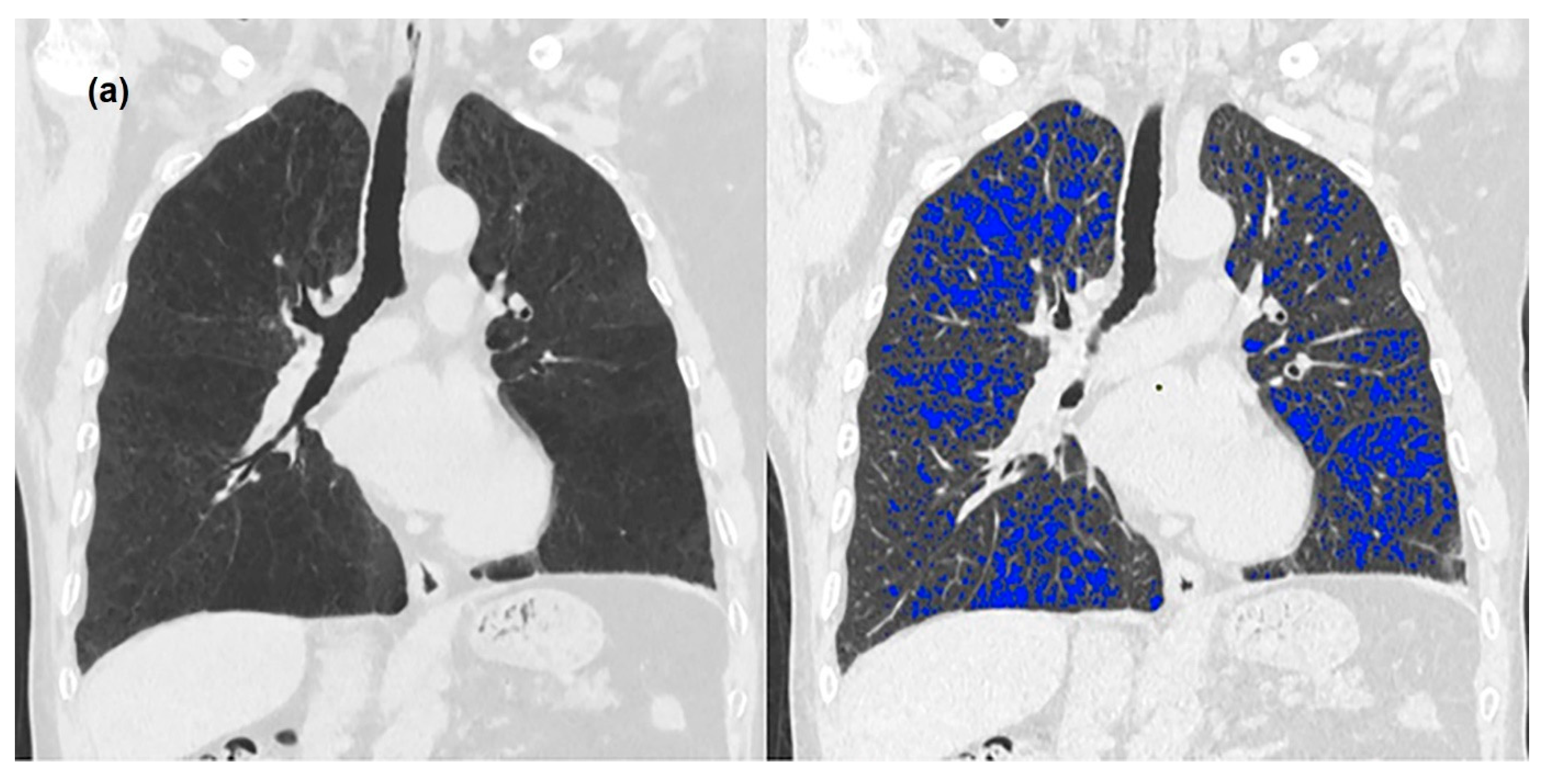 Medicina 58 00939 g001a Medicina 58 00939 g001a
