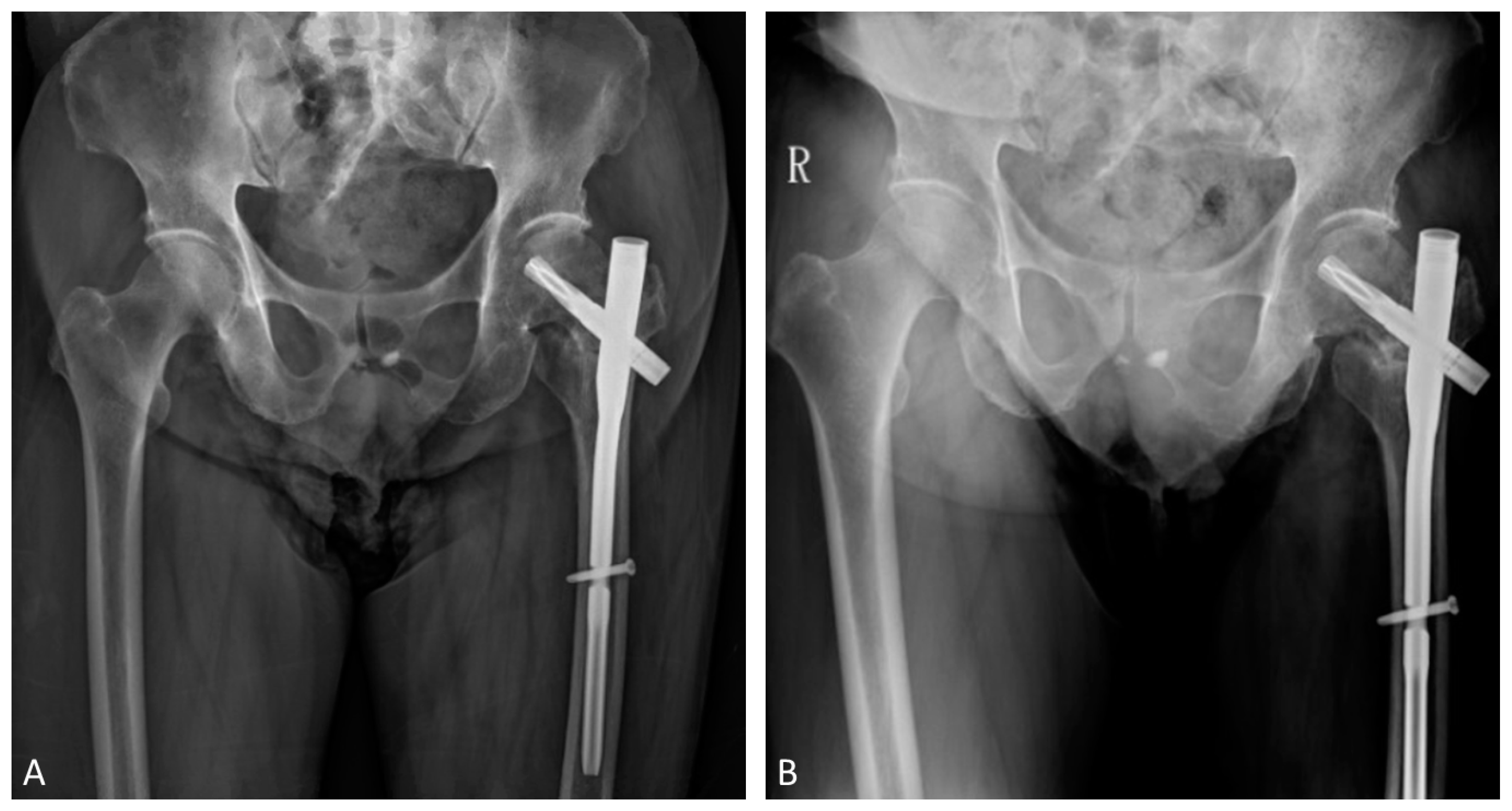 Medicina 58 00983 g003 Medicina 58 00983 g003