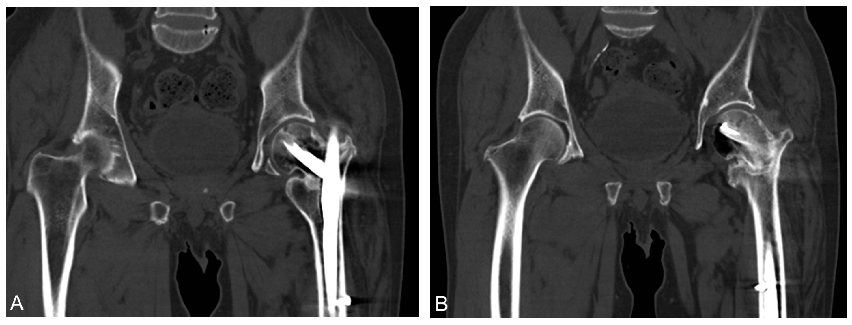 Medicina 58 00983 g005 Medicina 58 00983 g005