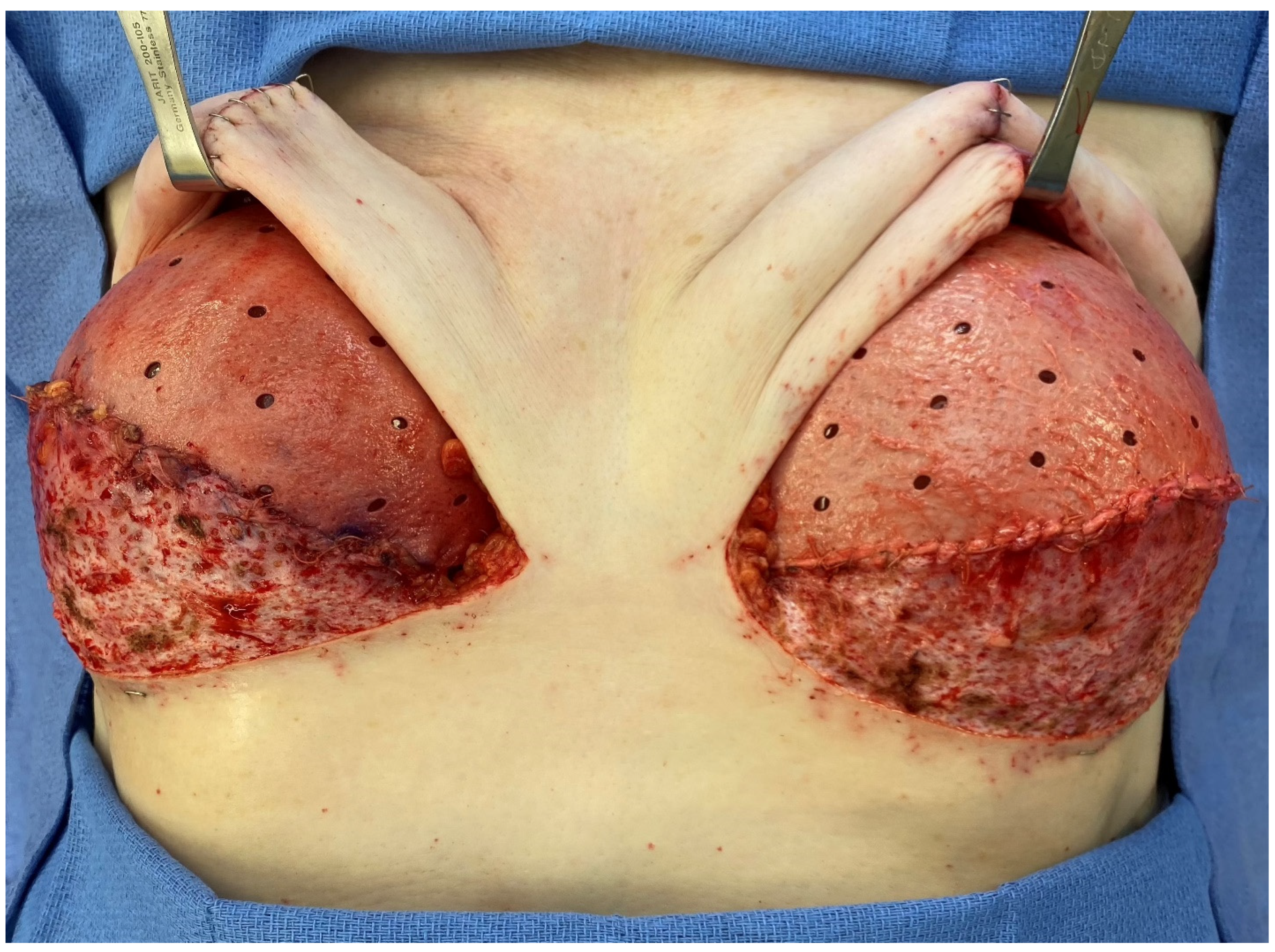 Medicina 58 00992 g002 550